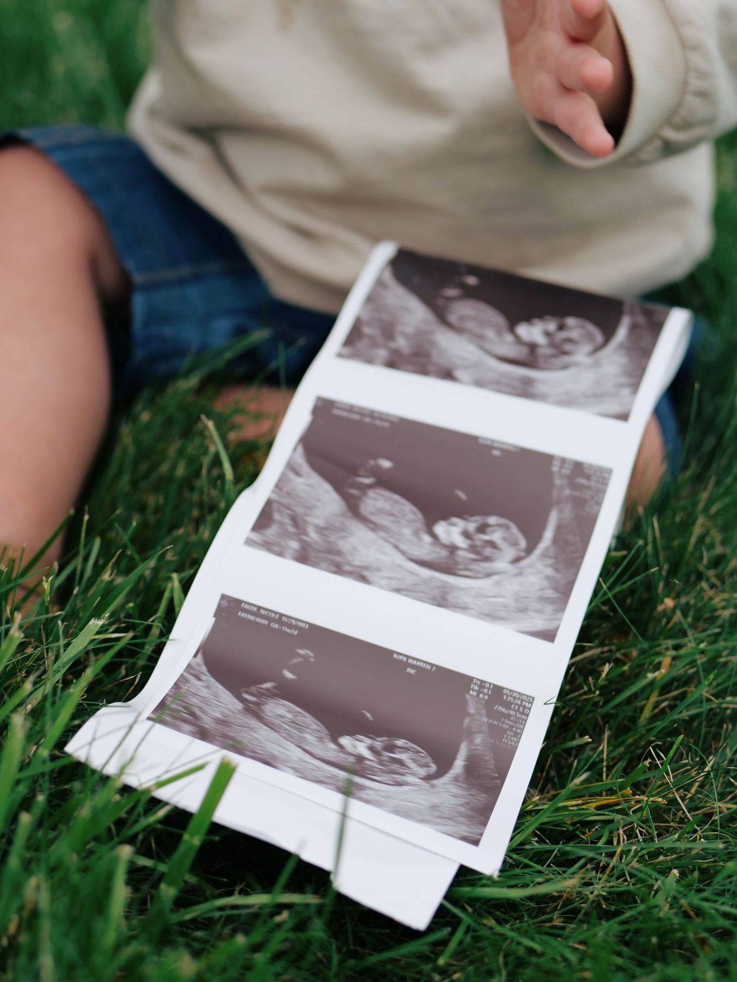Close-up of ultrasound photos on green grass with baby sitting nearby.