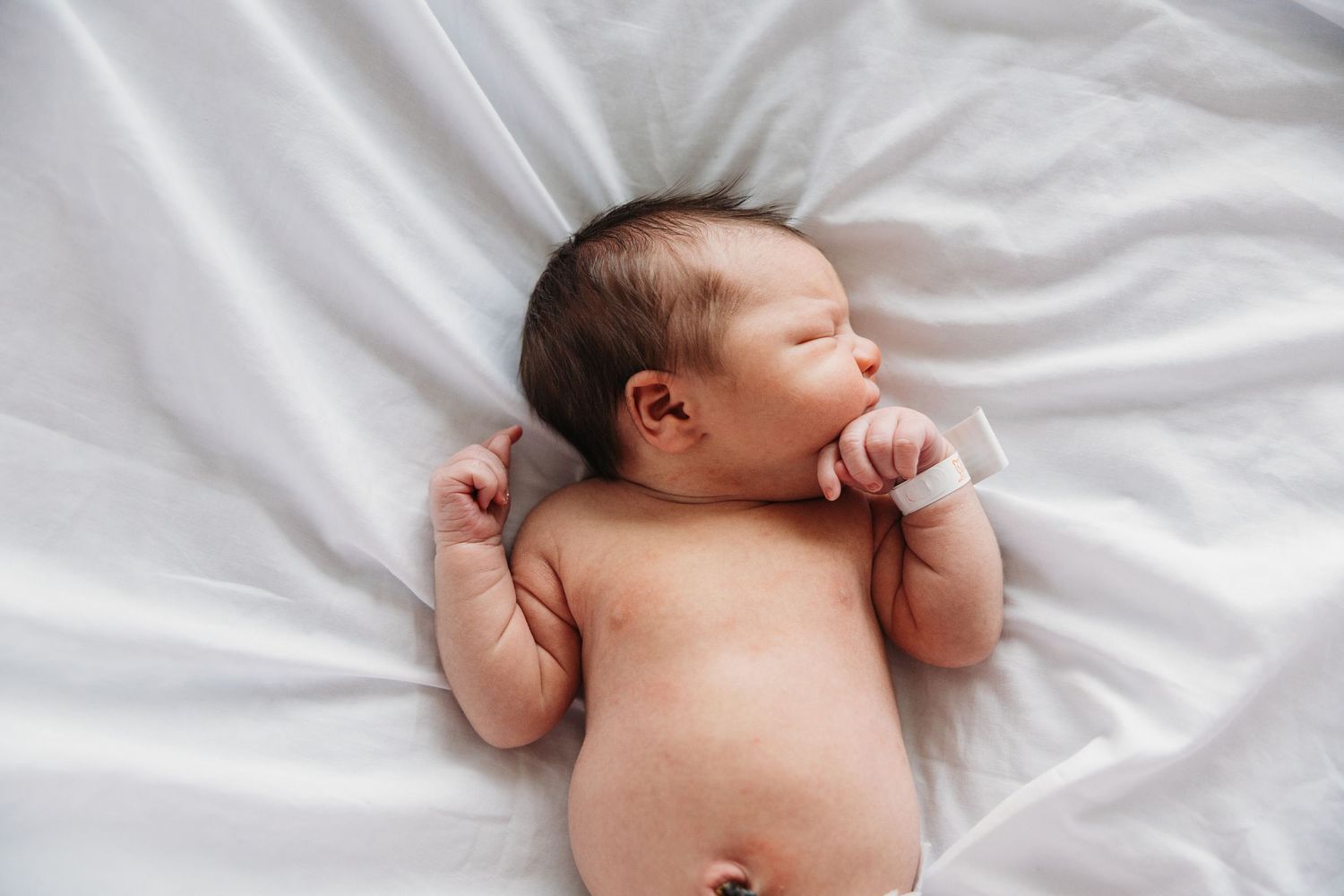 Newborn baby sleeping peacefully on white sheets, lying on back with arms raised, hospital wristband visible.
