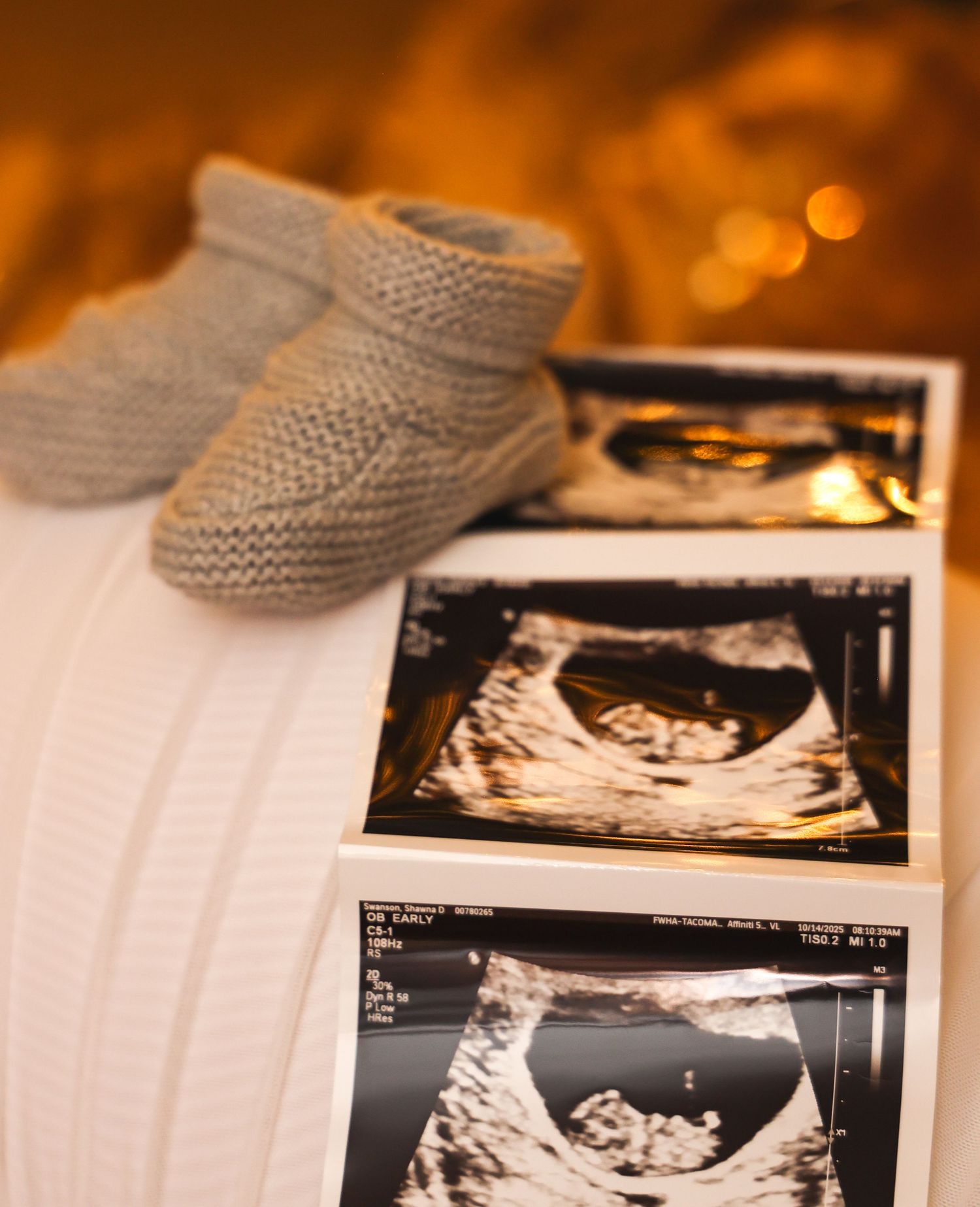 Baby booties and ultrasound photos arranged with warm lighting and bokeh background.