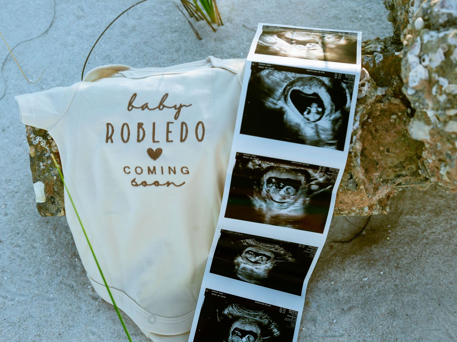 A series of black and white ultrasound photos displayed alongside white baby clothing items on a gray surface.