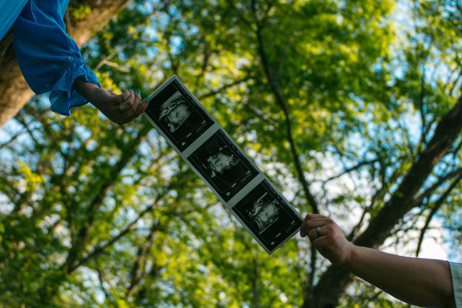 Hands holding ultrasound photos up against a canopy of green trees in natural light.
