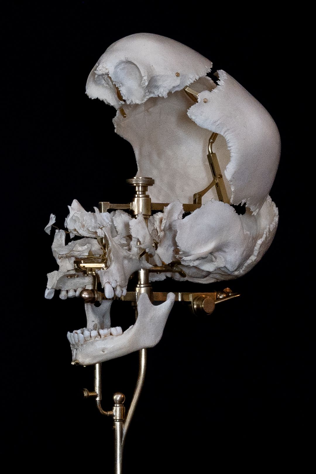 White anatomical skull model with brass hardware mechanisms shown in profile against black background.