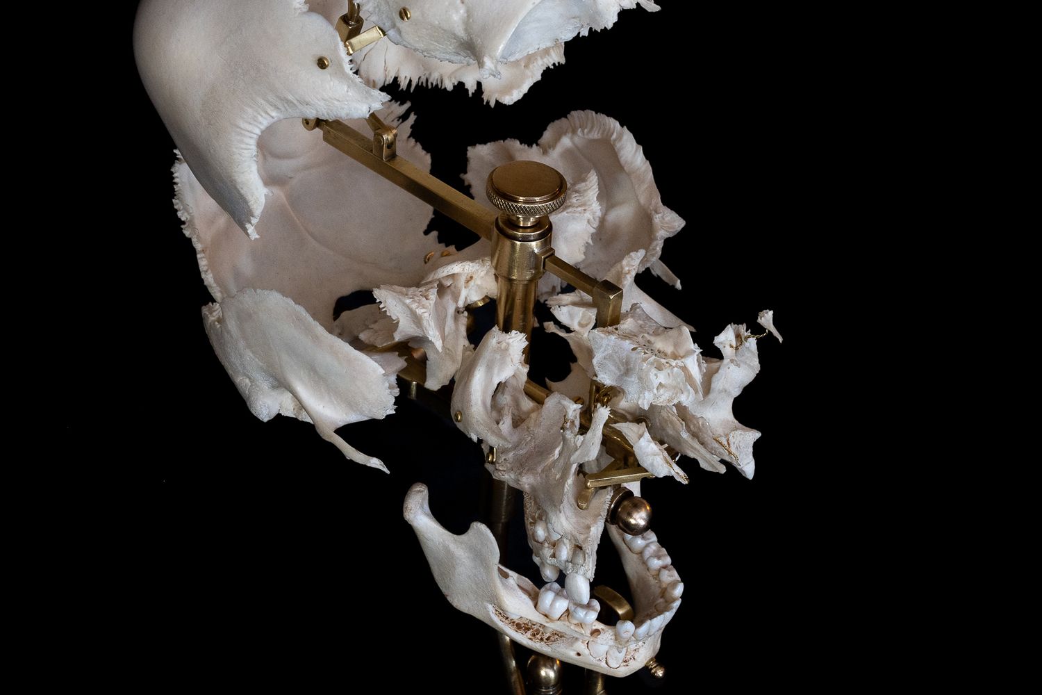 Anatomical skull model showing dental structure with brass mounting apparatus.
