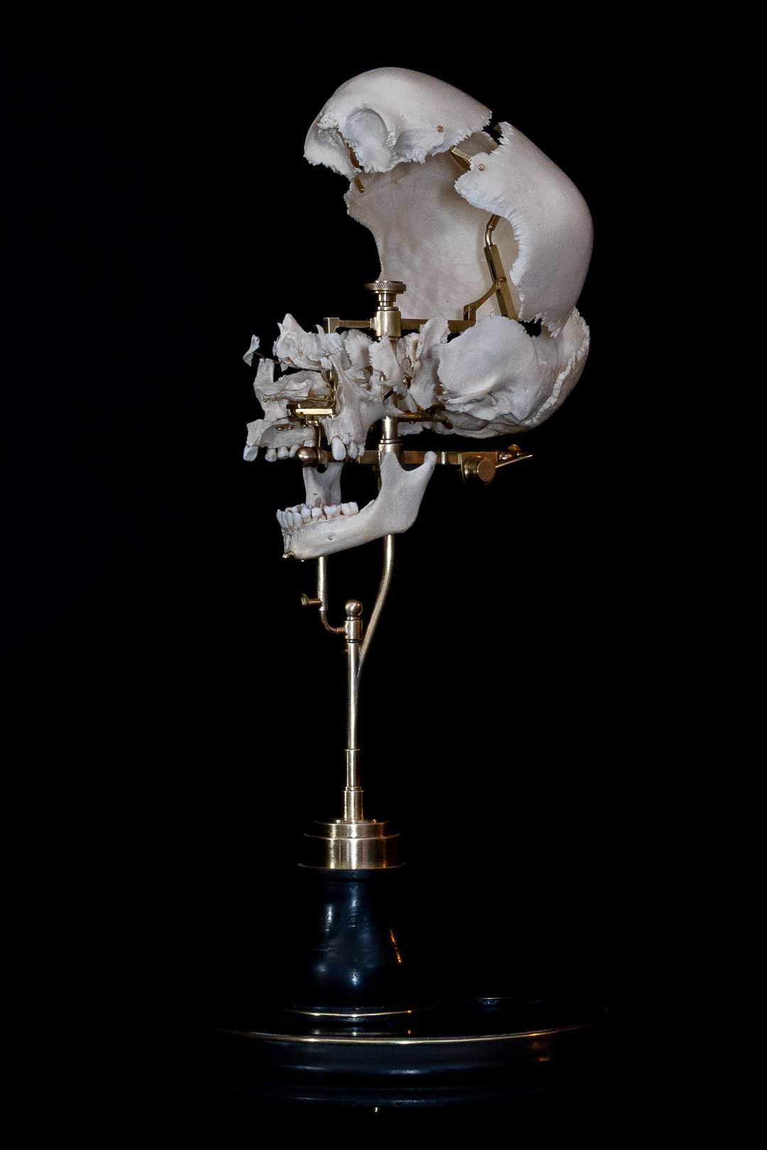 Medical teaching skull mounted on display stand with brass fixtures, viewed from lateral angle.