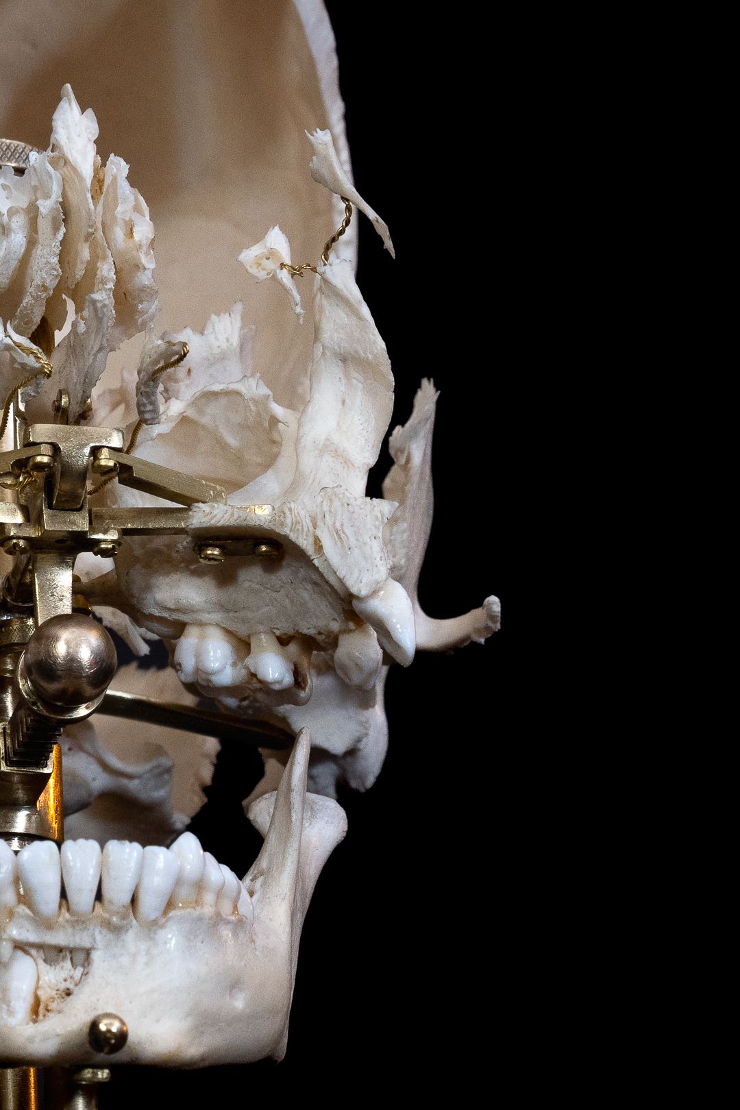 Profile view of mounted skull specimen displaying dental arrangement and bone structure.