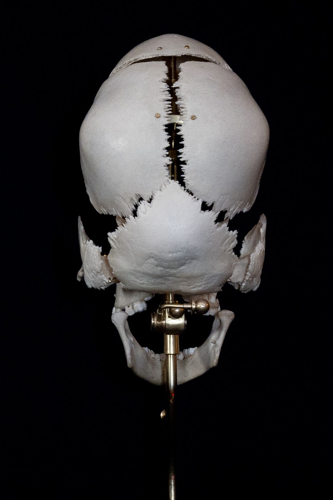 Medical skull model with metal support rod shown from posterior view on dark background.