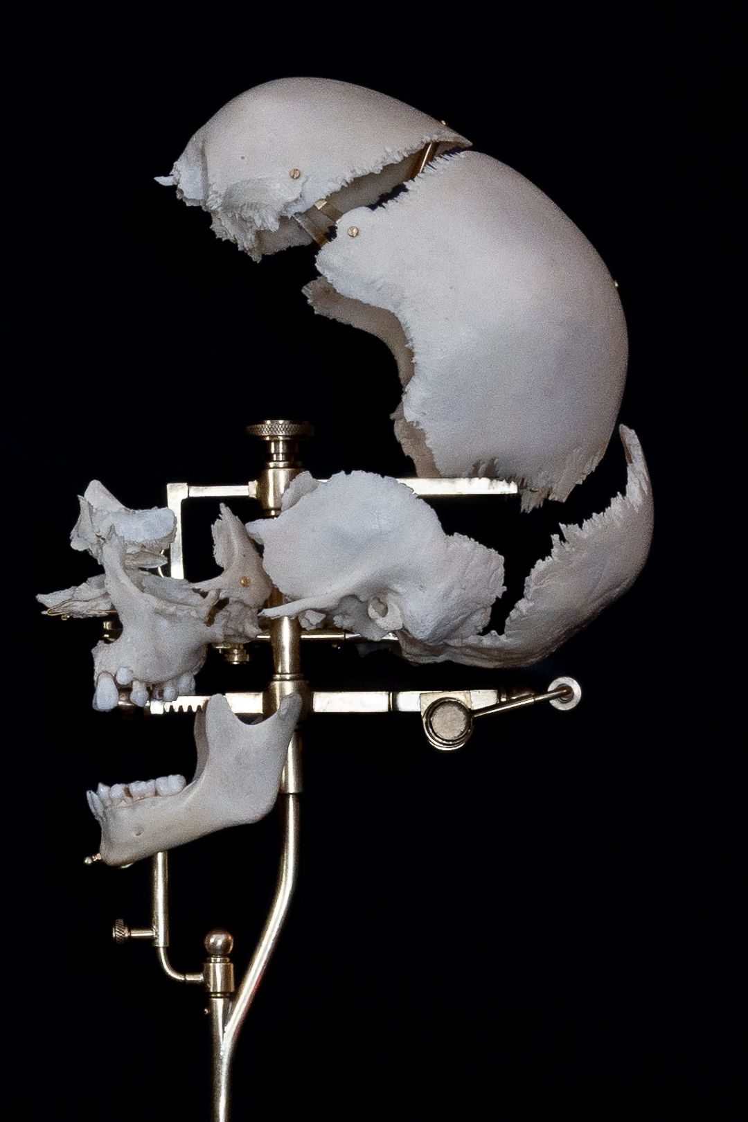Exploded view of skull segments mounted on mechanical display apparatus.