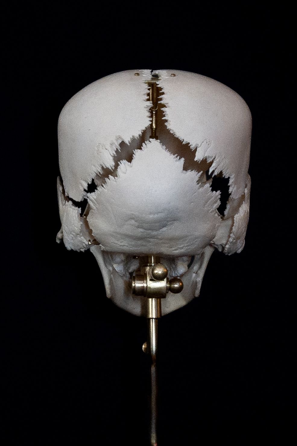 Back view of segmented skull showing detailed crack patterns on metal mount.