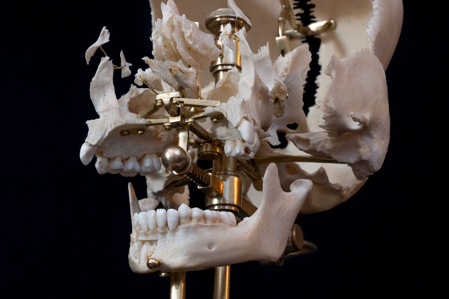 Anatomical skull specimen displayed on brass mounting hardware against black background.