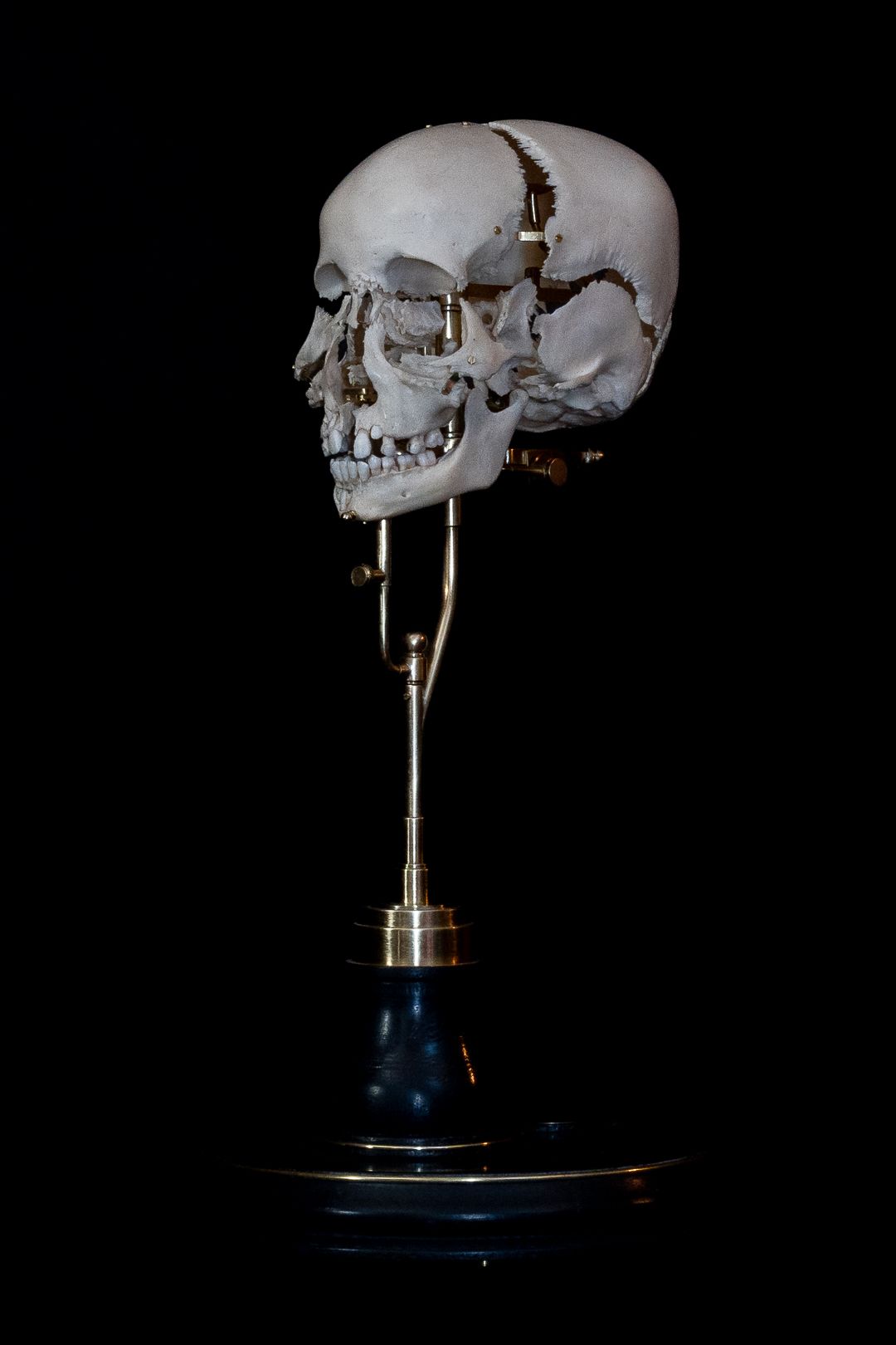 Anatomical skull specimen mounted on blue base photographed against black background.