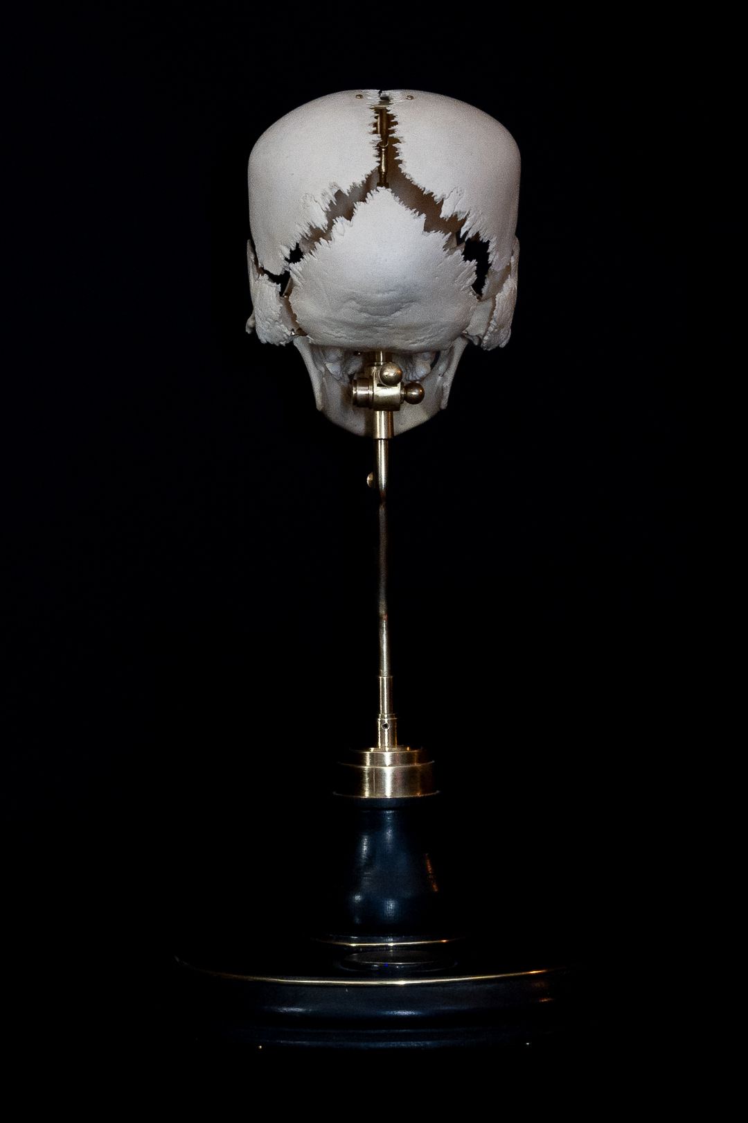 Full length view of white skull mounted on blue base showing fracture patterns.