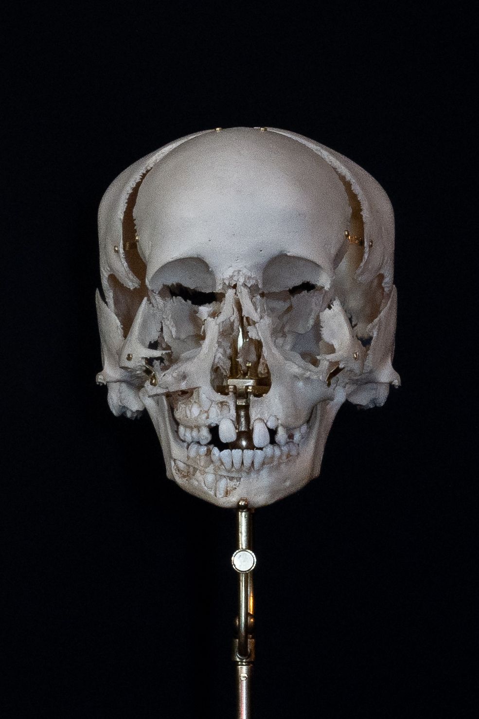 Close-up frontal view of white skull model with metal mounting hardware.