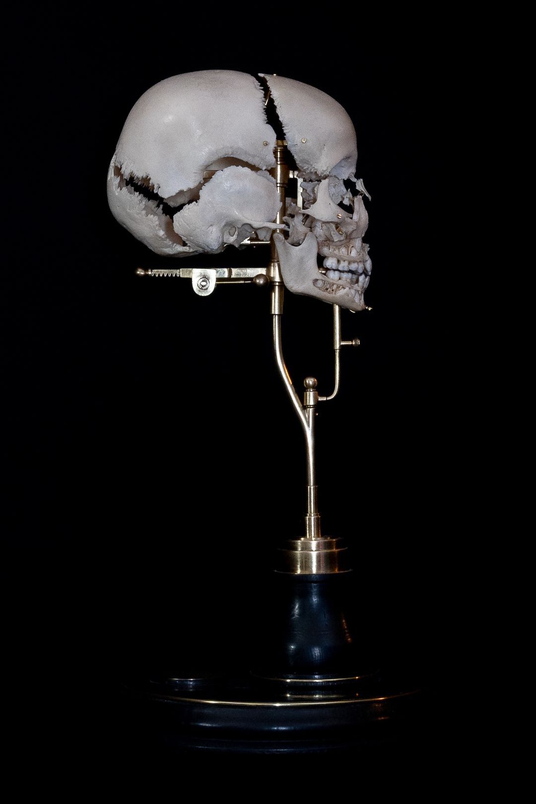 Anatomical skull display on circular blue pedestal with articulated metal mounting system.