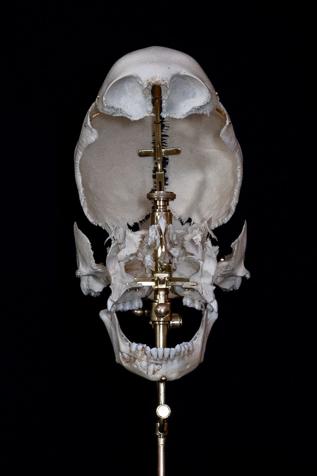 Medical skull display showing detailed bone structure on a dark stand against black background.