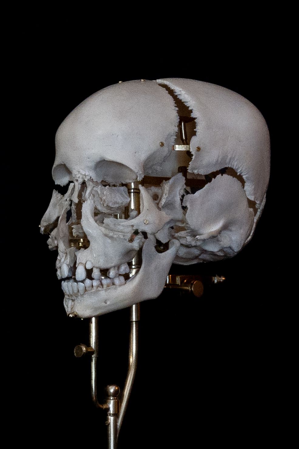 Side view of detailed skull model showing bone structure and mounting hardware.