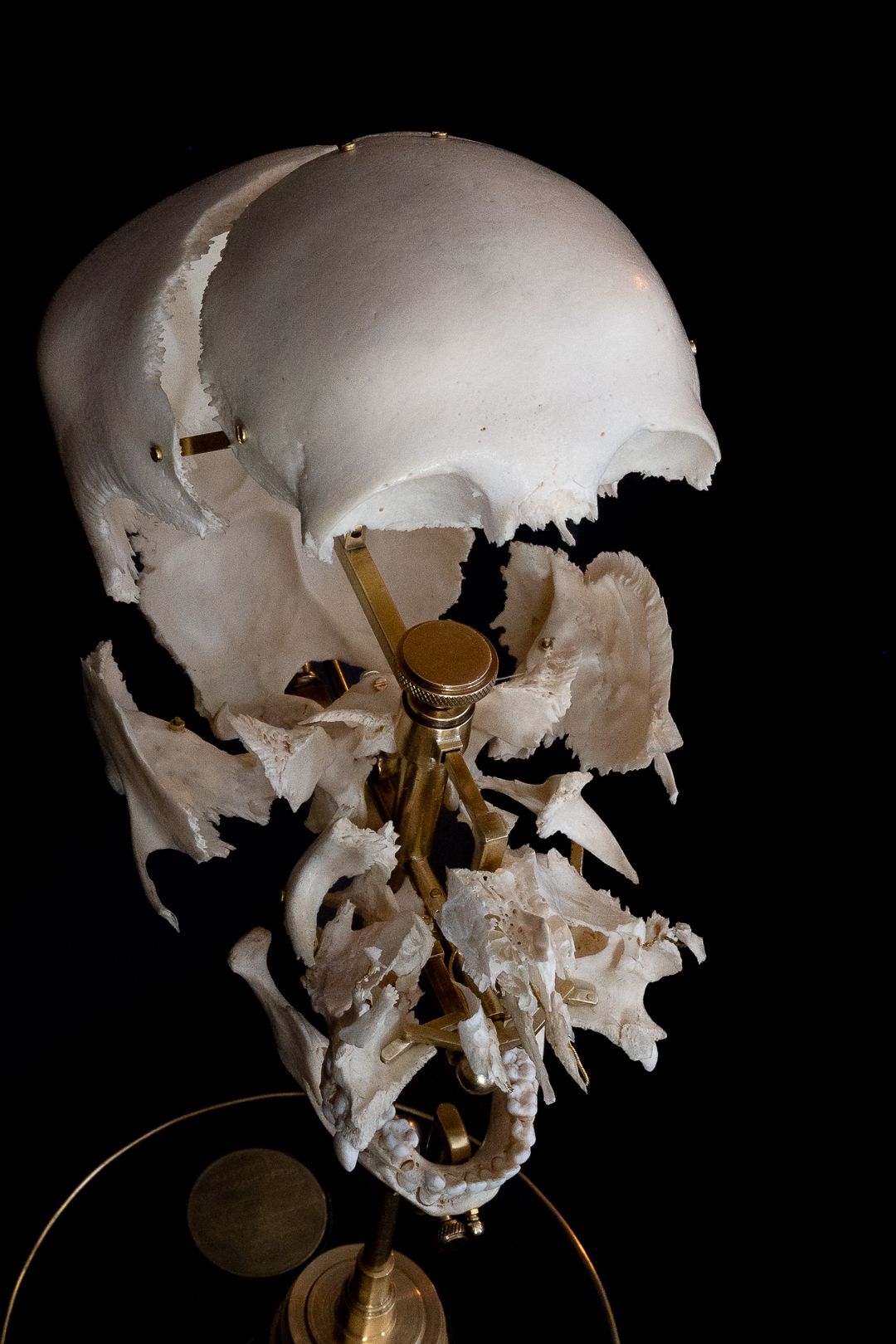 A disassembled human skull mounted on a brass stand against a black background.