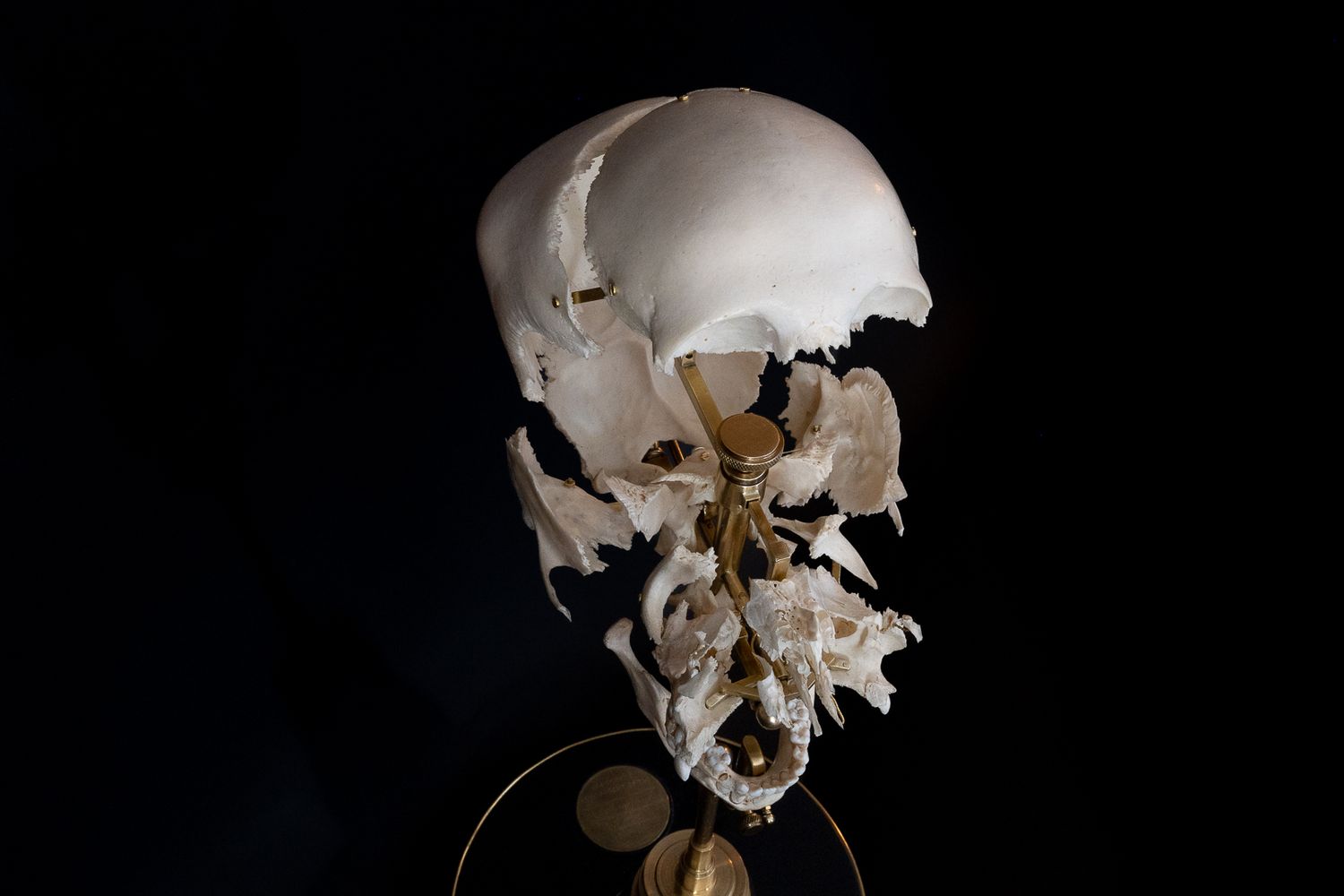 A human skull specimen mounted on a display stand against a black background.