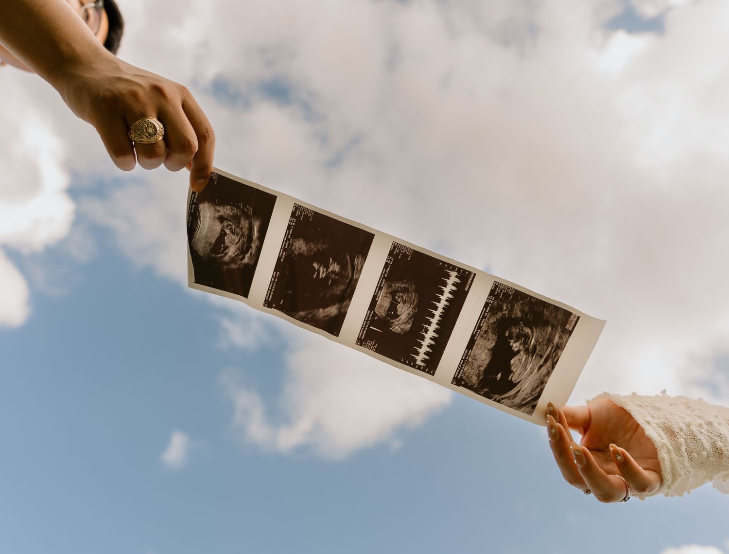 Two people holding ultrasound photos against a blue sky with clouds, announcing a pregnancy.