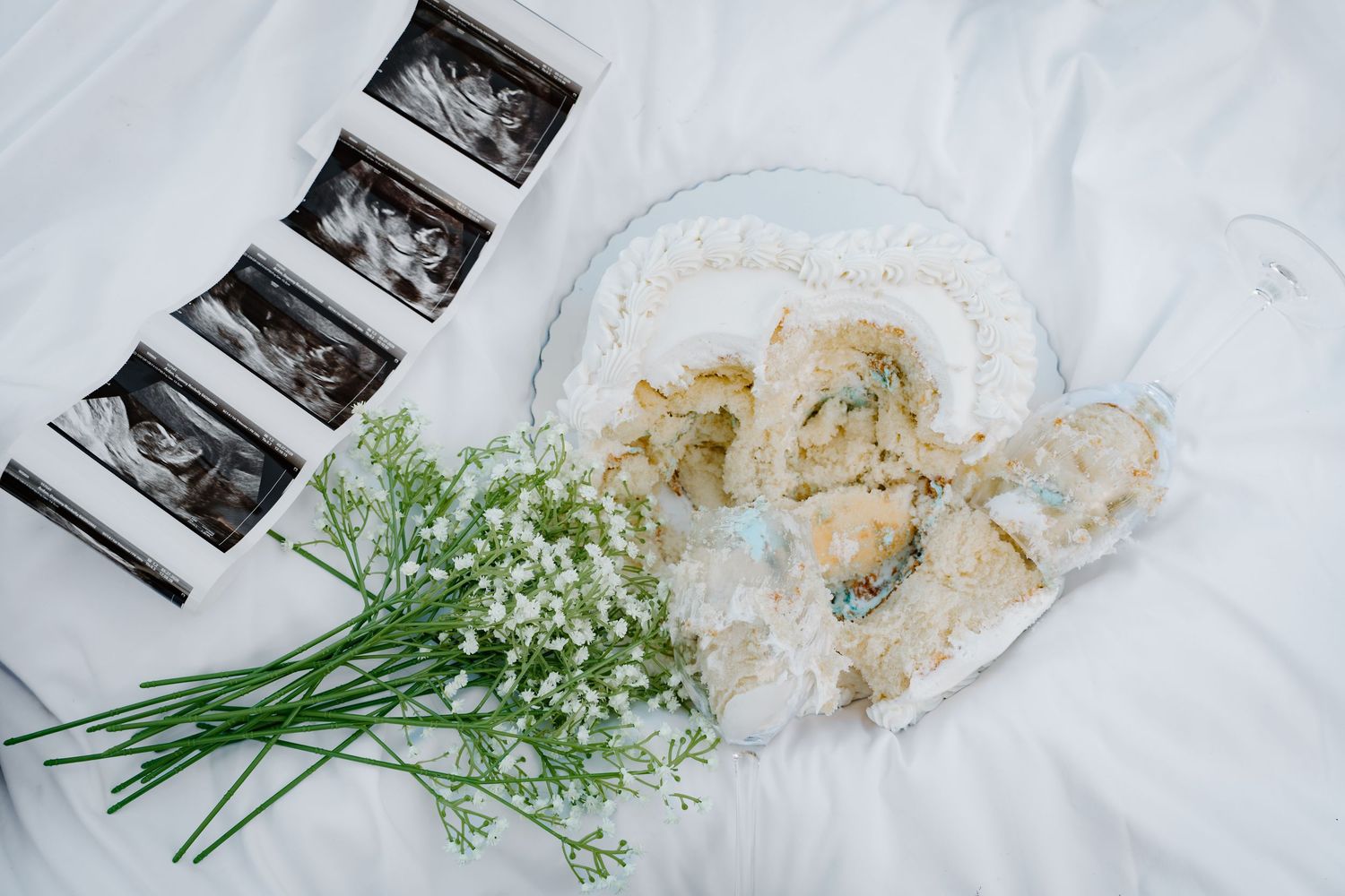 Ultrasound scans, baby booties, white flowers, and lace on a white bed for a pregnancy announcement flatlay.