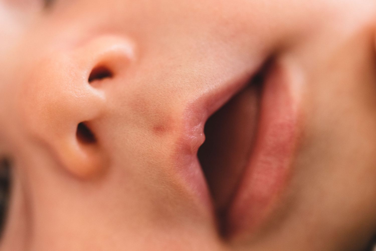 Extreme close-up macro photograph of lips and nose showing skin texture and details.