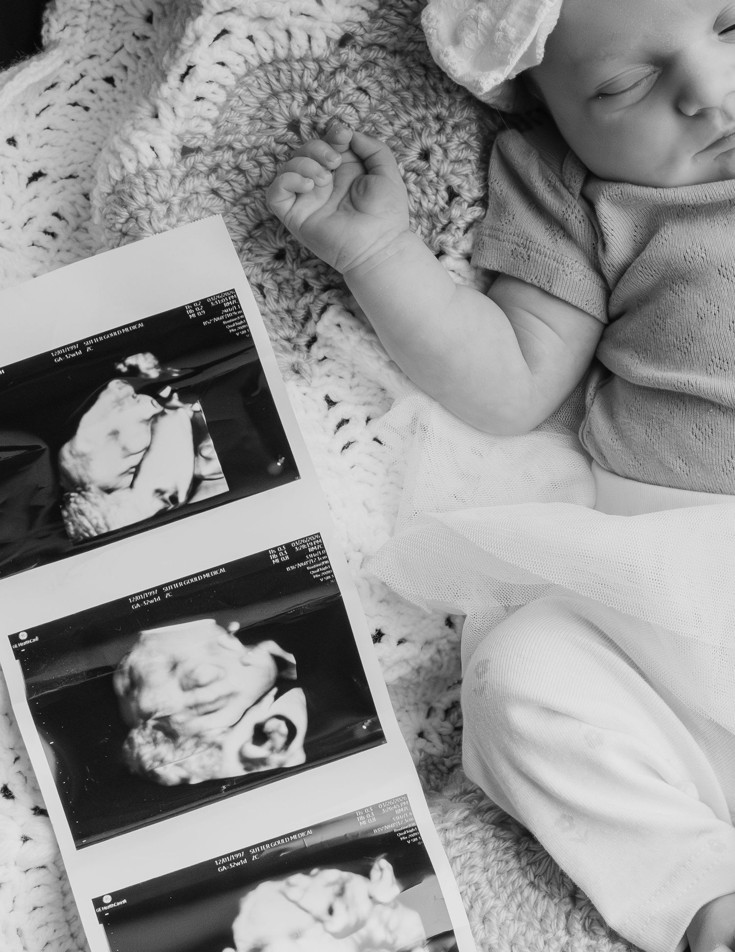 Black and white photo of sleeping newborn baby beside ultrasound sonogram prints on a crochet blanket captured by Jolie & Rae Photography