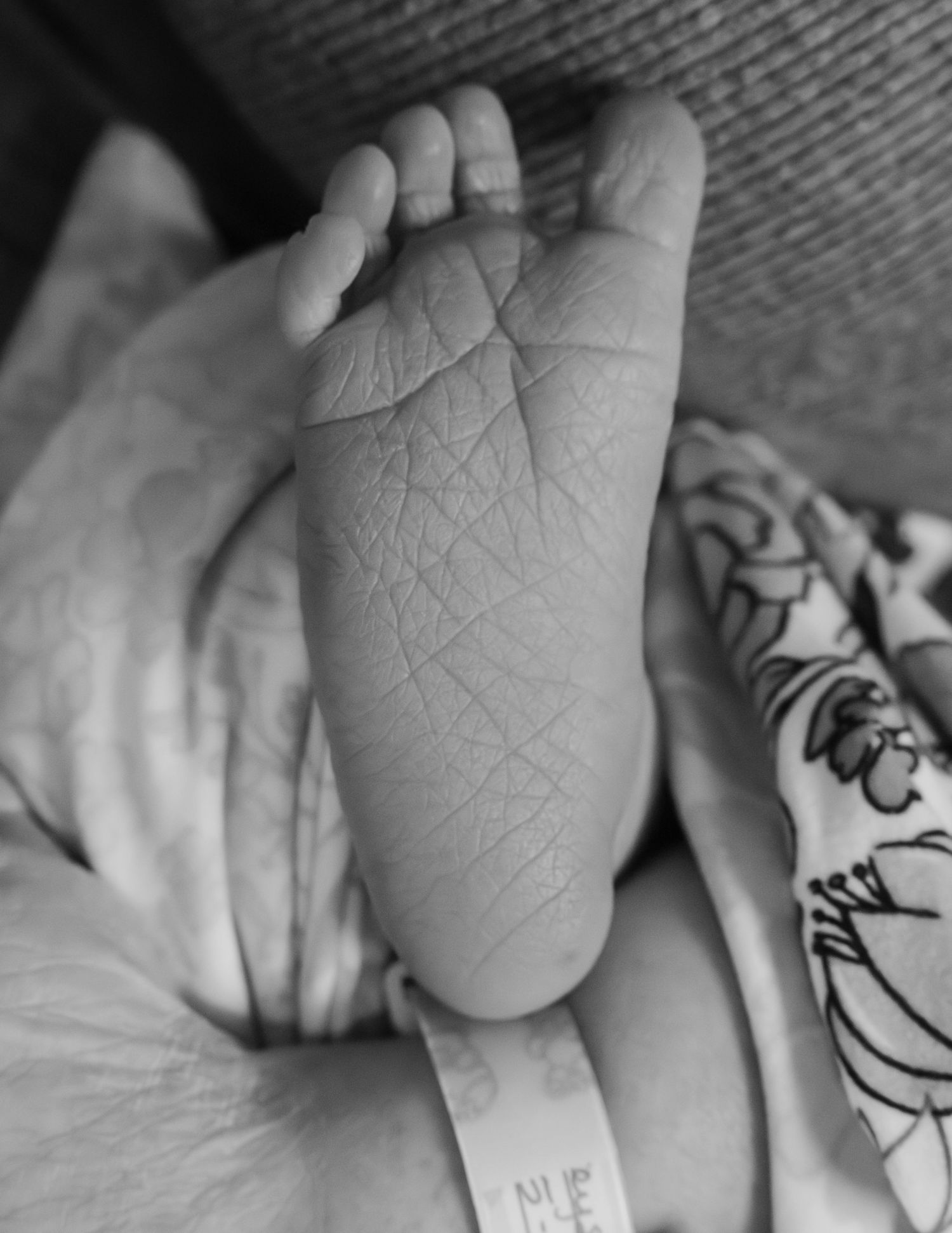 Close-up black and white photo of a newborn baby's tiny foot with a hospital identification bracelet.