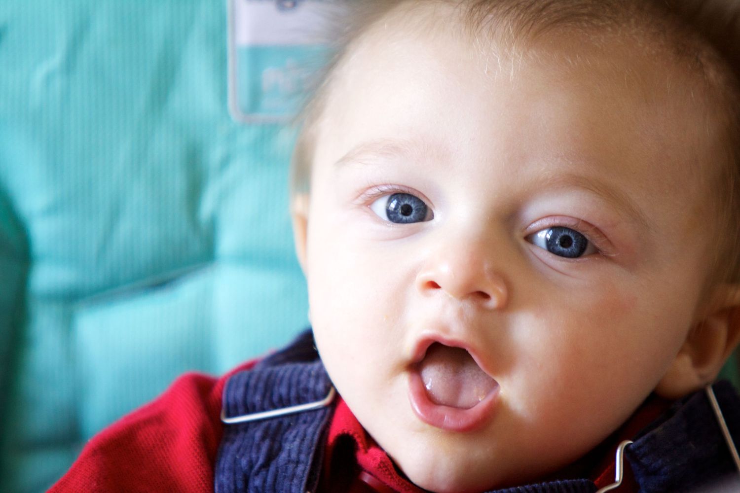 A baby with a cleft lip smiles while wearing a navy blue sweater against a turquoise background.