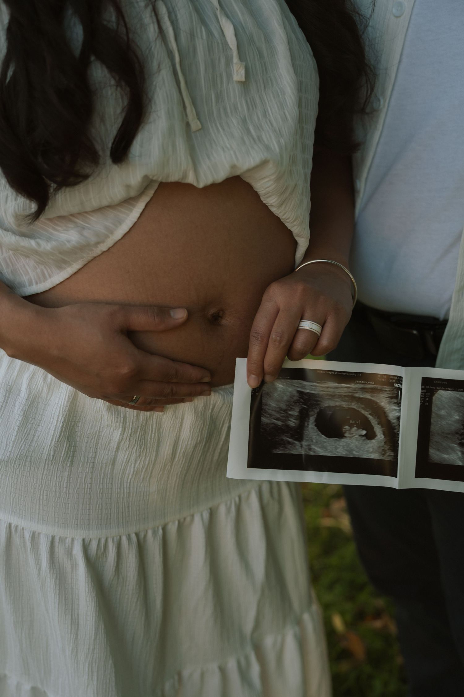 Pregnant woman in white dress holds baby ultrasound photos with partner, showing wedding ring and baby bump.