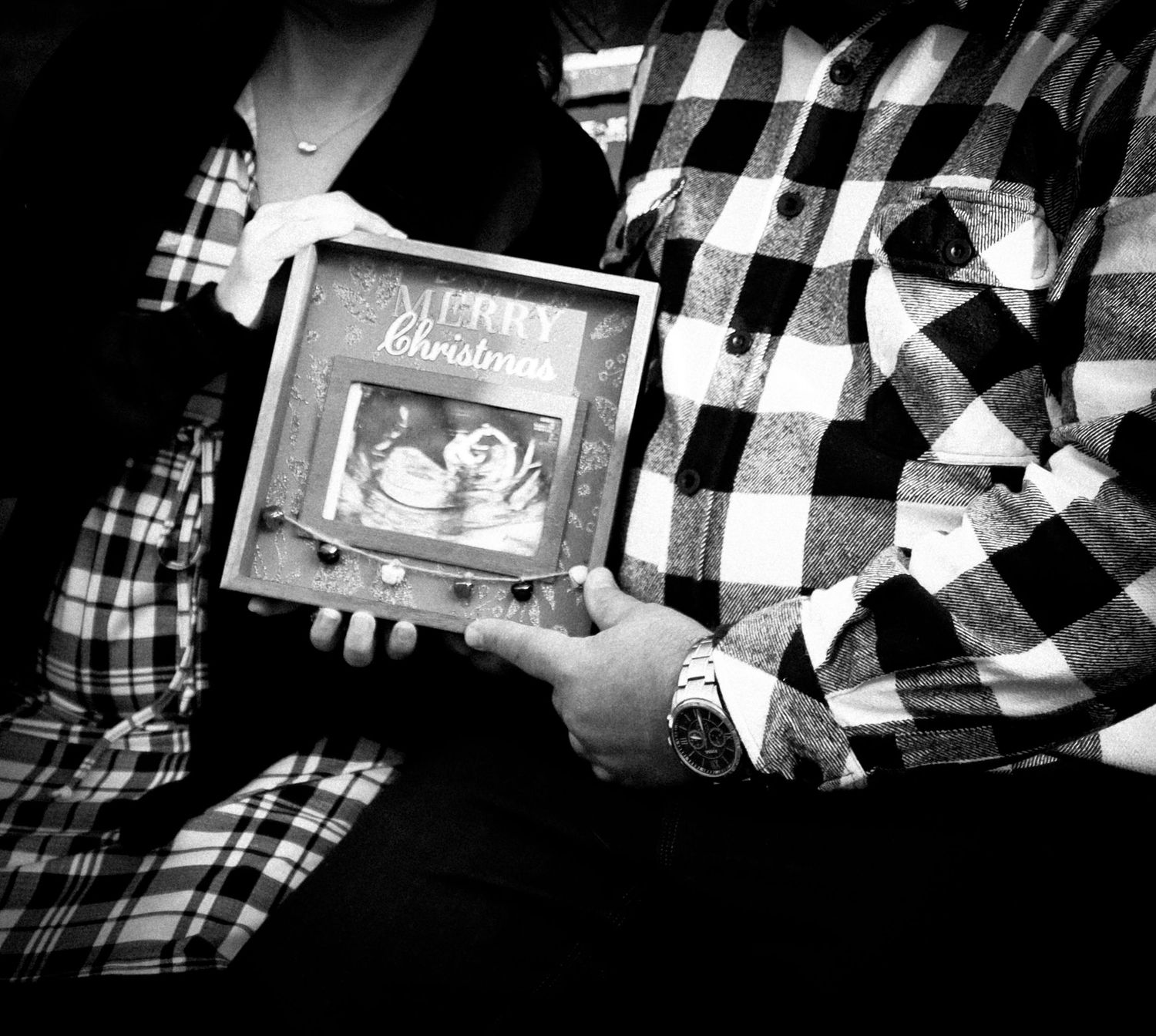 A series of black and white photographs showing hands holding ultrasound images in a plaid shirt pattern.
