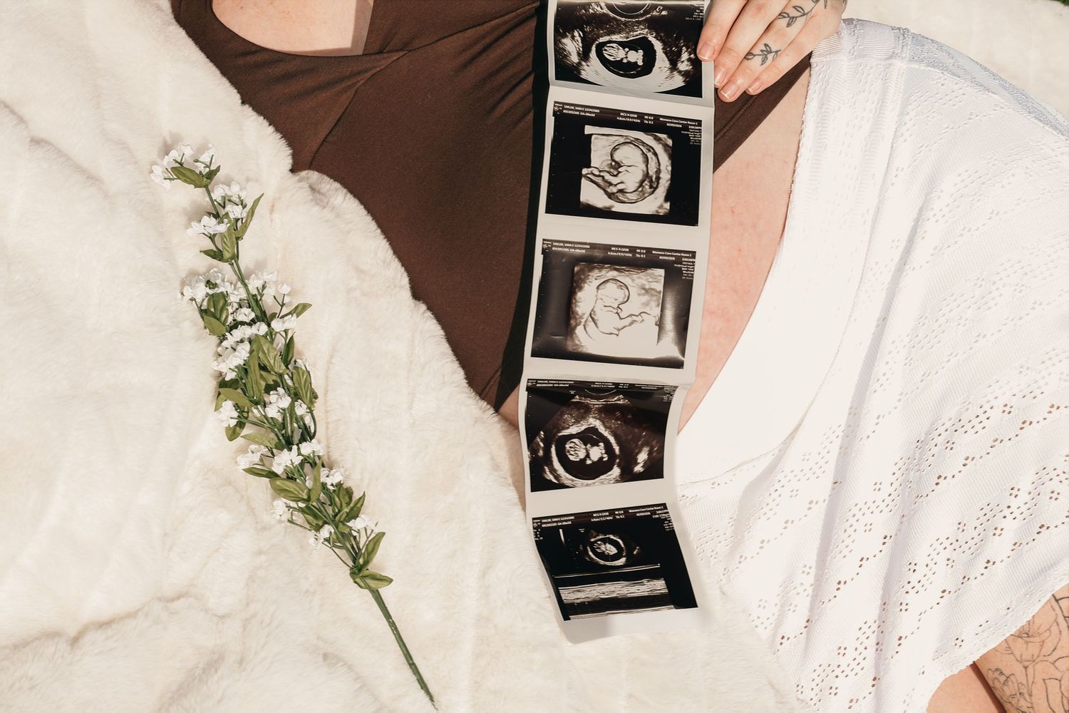 Overhead view of a strip of ultrasound photos on a soft white blanket beside a sprig of greenery and a pregnant belly.