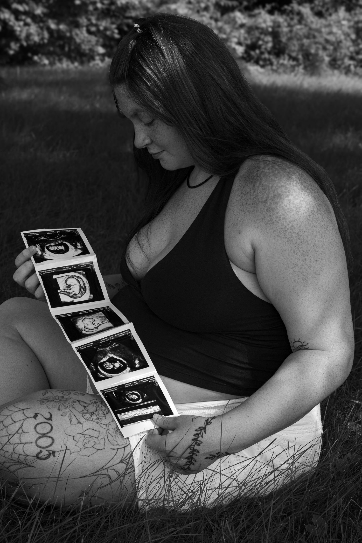 Black and white photo of an expectant mother sitting on grass, looking down at a strip of ultrasound images.