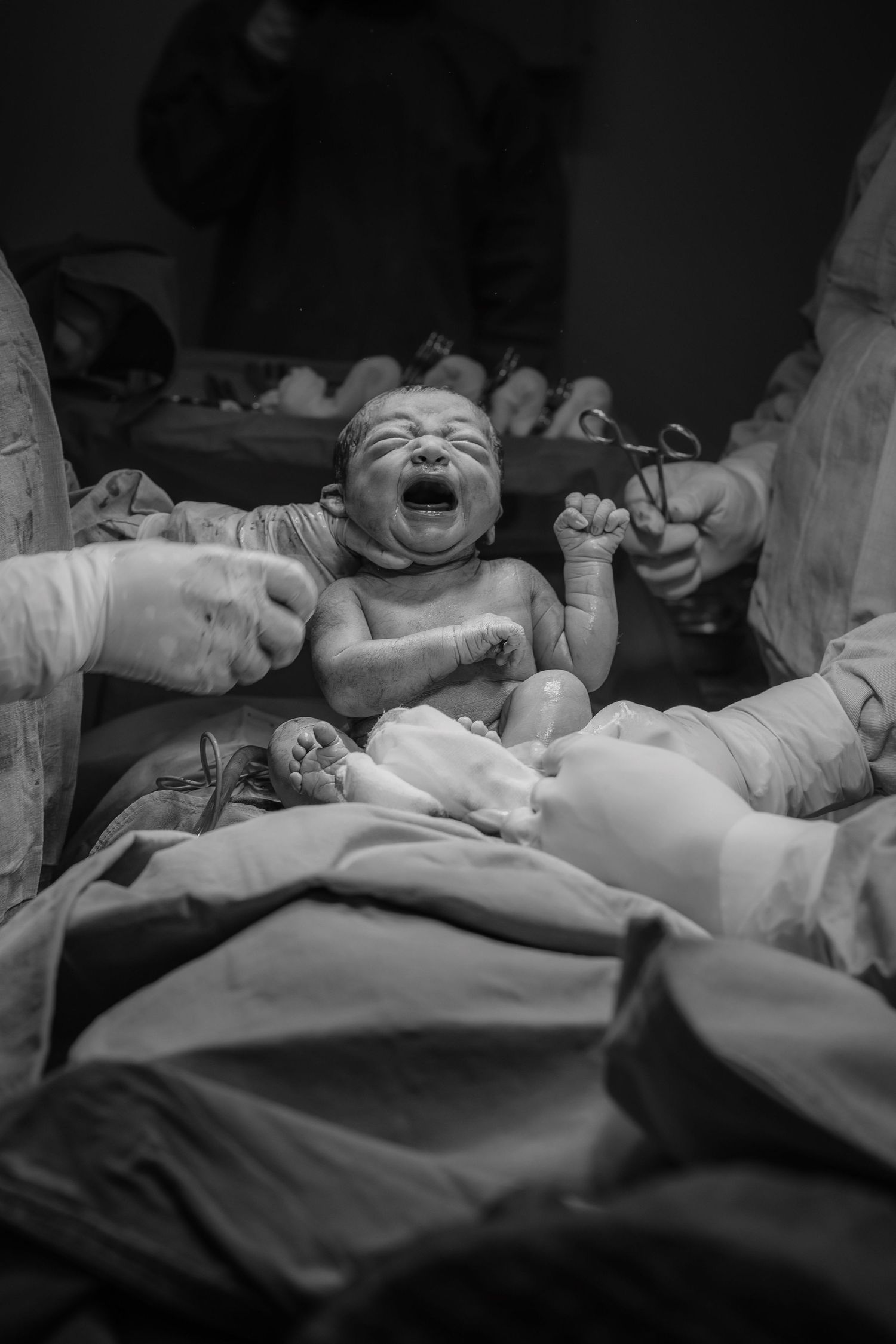 Black and white photo of crying newborn baby held by medical team immediately after delivery.
