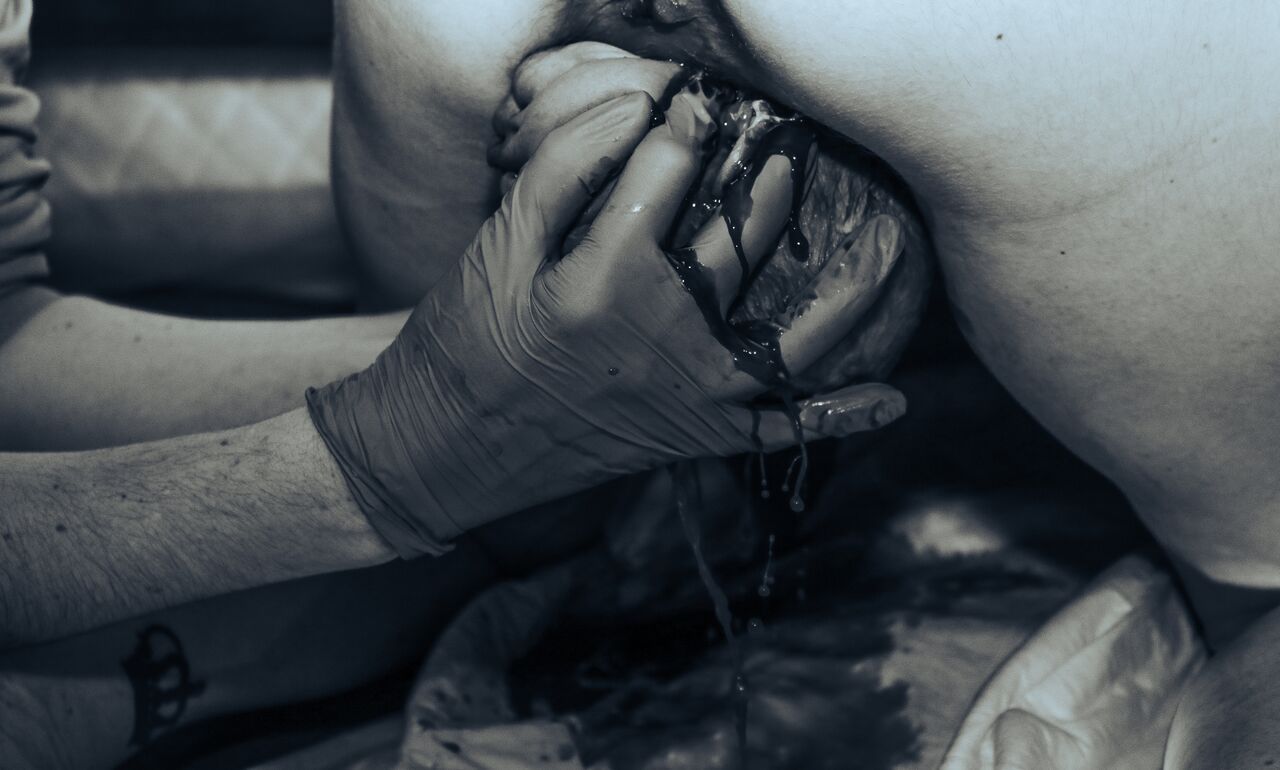 Close-up of a tattoo artist applying black ink tattoo on skin using a tattoo machine while wearing black gloves.