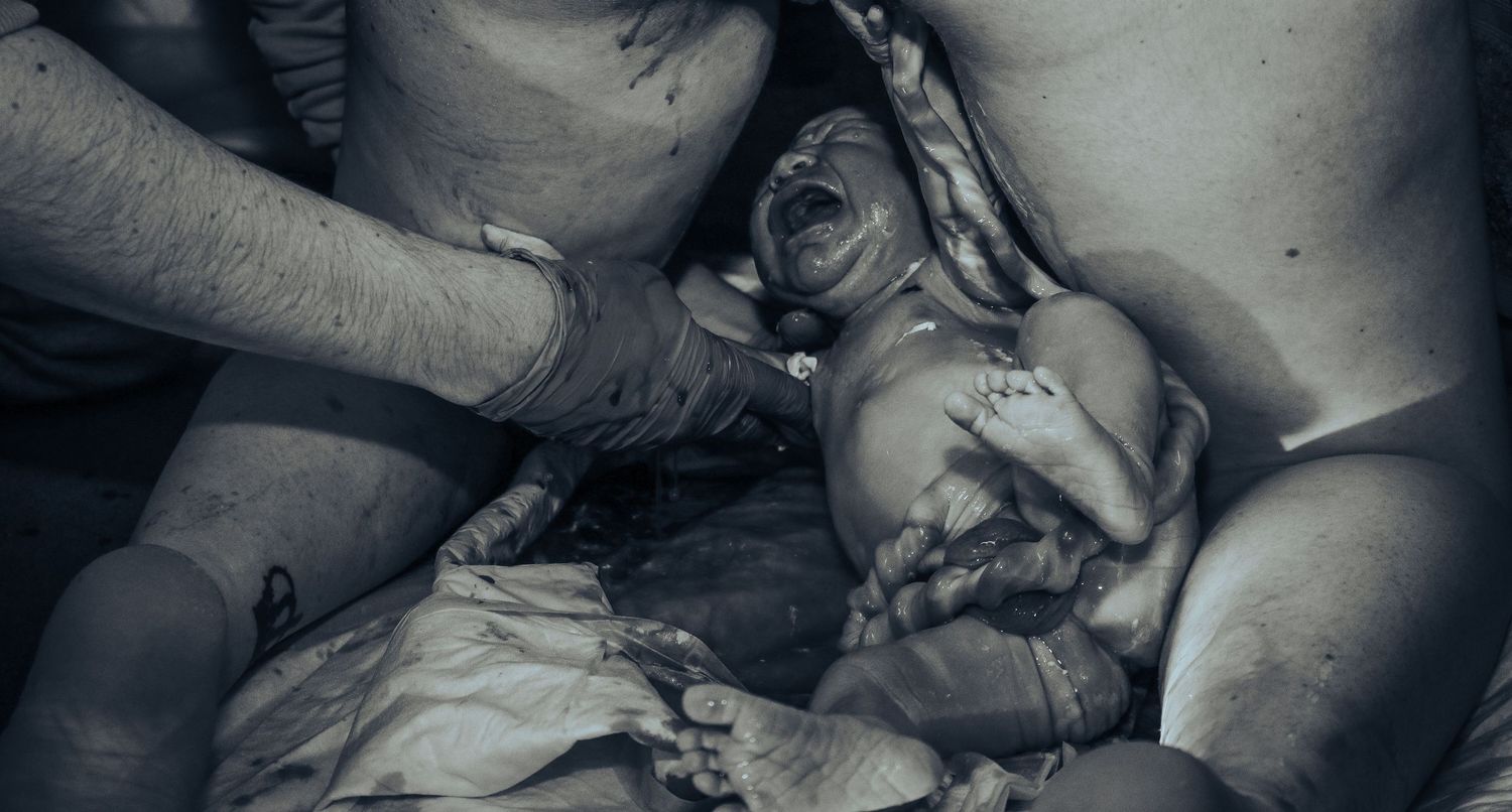 Black and white photo of a newborn baby being delivered, crying moments after birth.