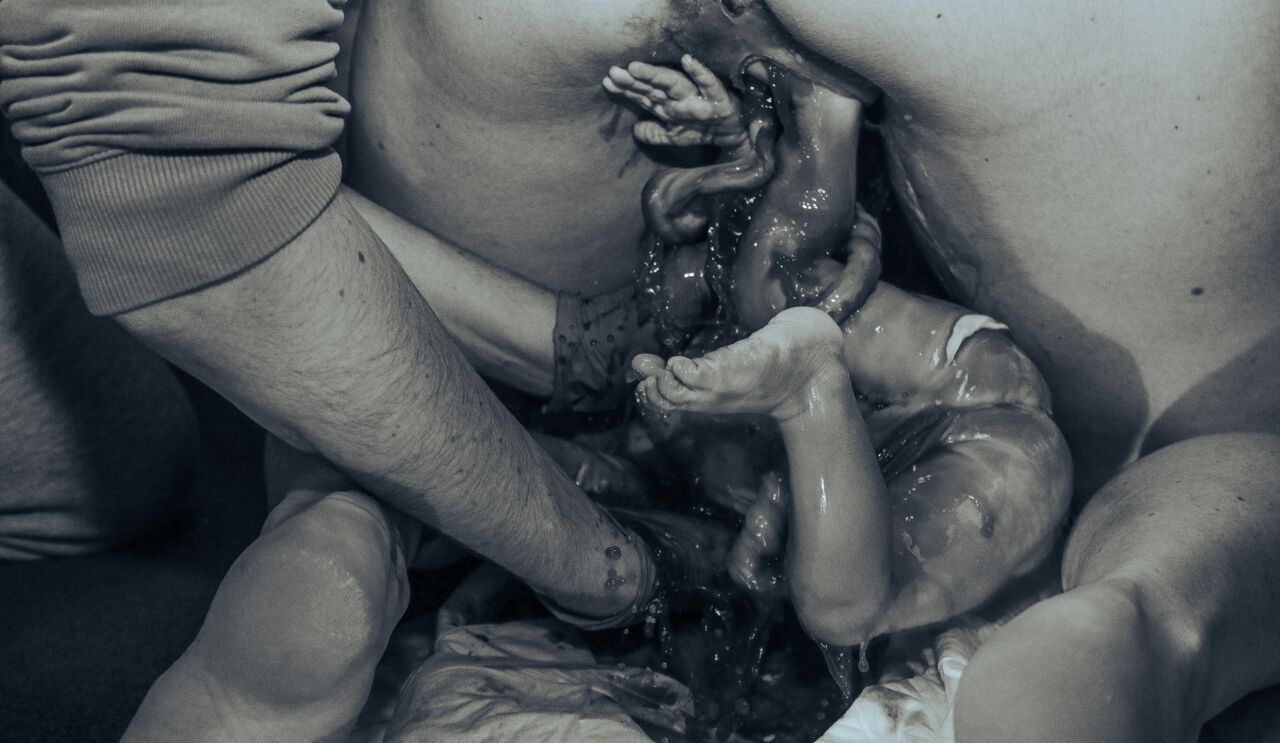Black and white photograph capturing the miraculous moment of childbirth with a newborn baby emerging.