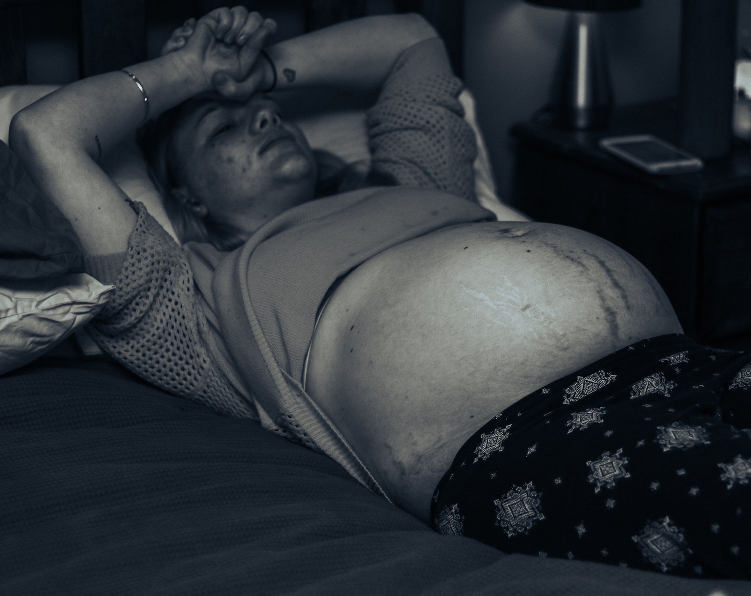 Person lying on bed with exposed abdomen in dimly lit room, wearing patterned shorts, resting with arm behind head.