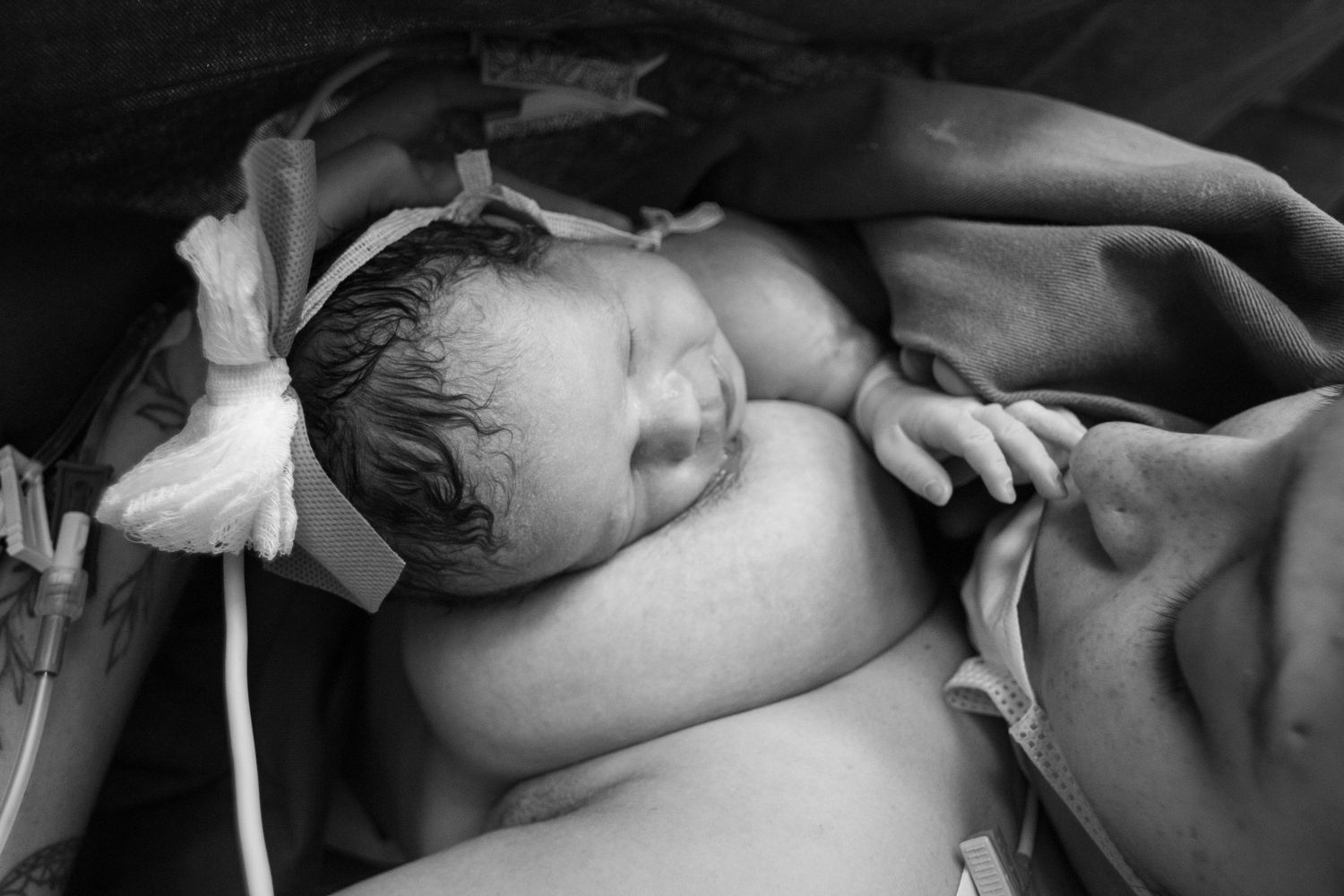 Black and white photo of a newborn baby with umbilical cord clip resting on mothers chest.