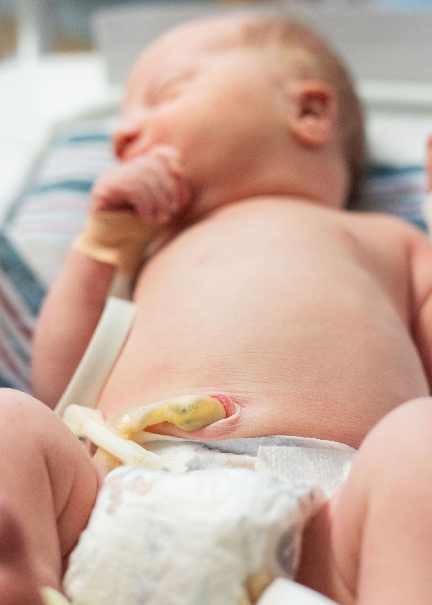 Close-up of a newborn baby with umbilical cord clamp visible lying in hospital bassinet.