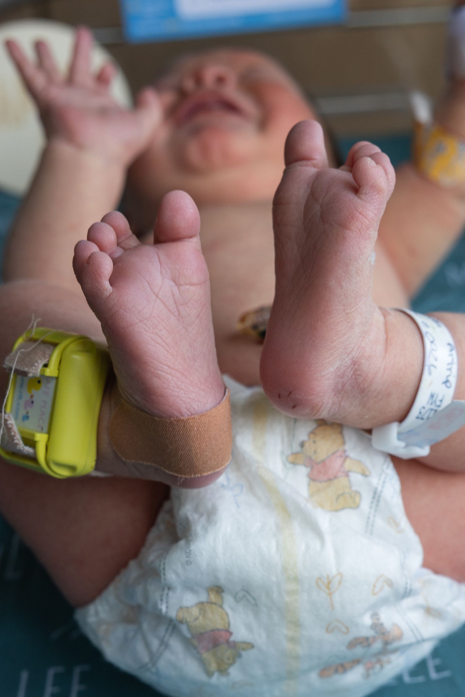 Close-up of newborn baby feet with hospital ID bracelet and bandage on ankle.