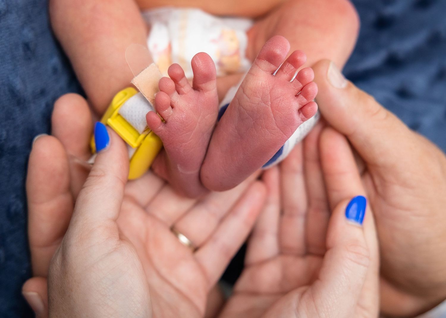 Adult hands cradling tiny newborn baby feet with hospital ID bracelet on blue background.