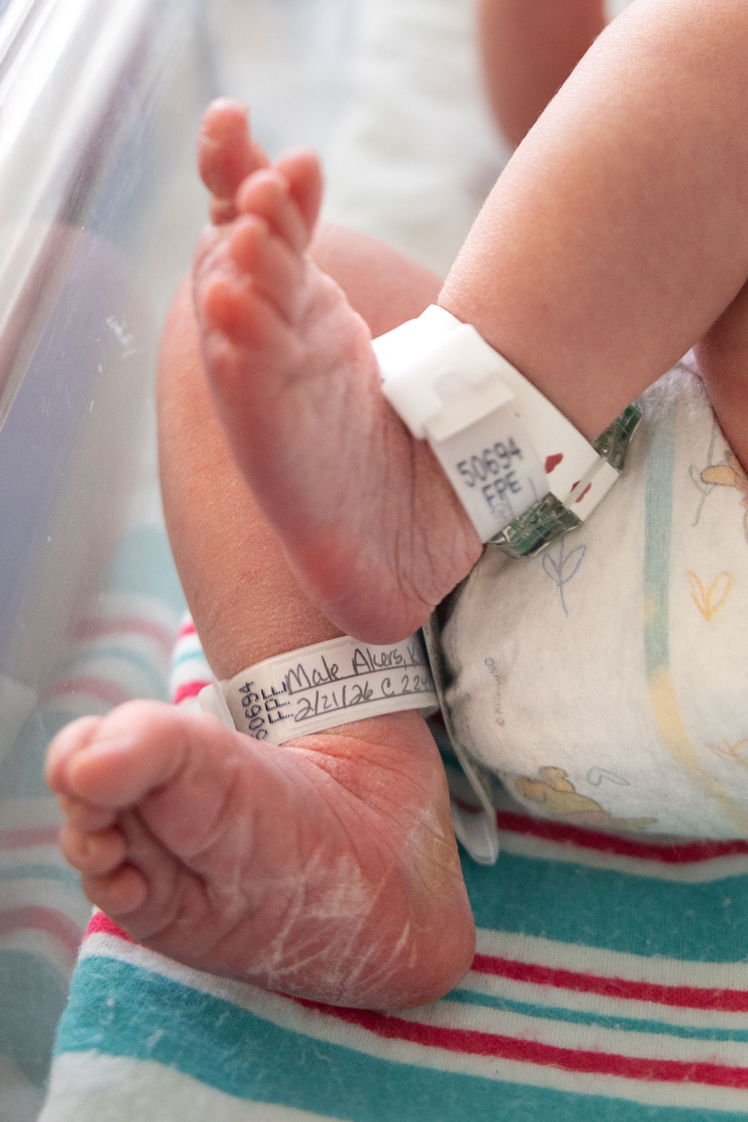 Close-up of a newborn baby's feet with hospital identification bracelet on striped blanket.