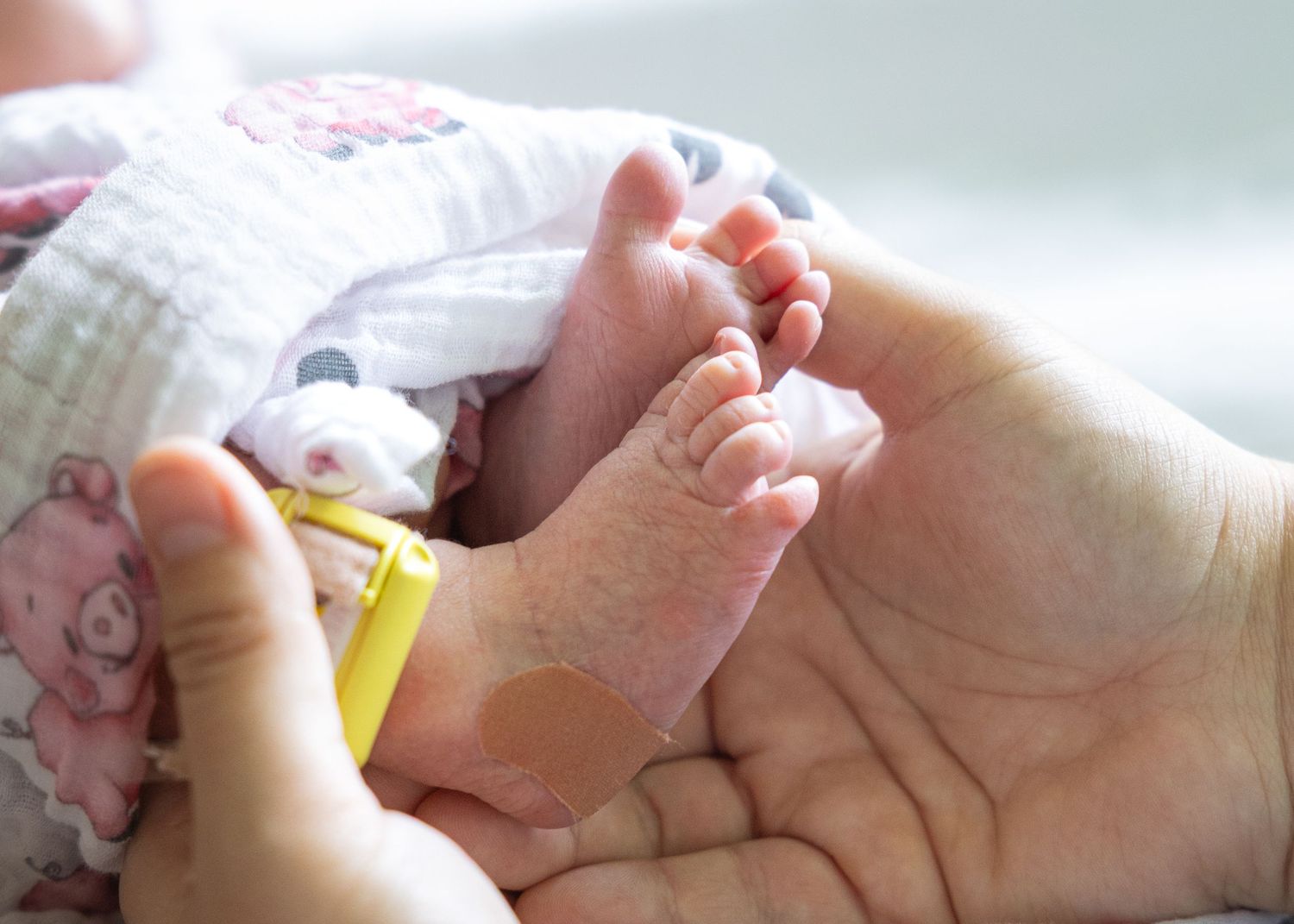 Adult hand gently cradling tiny newborn baby feet with yellow hospital ID bracelet.