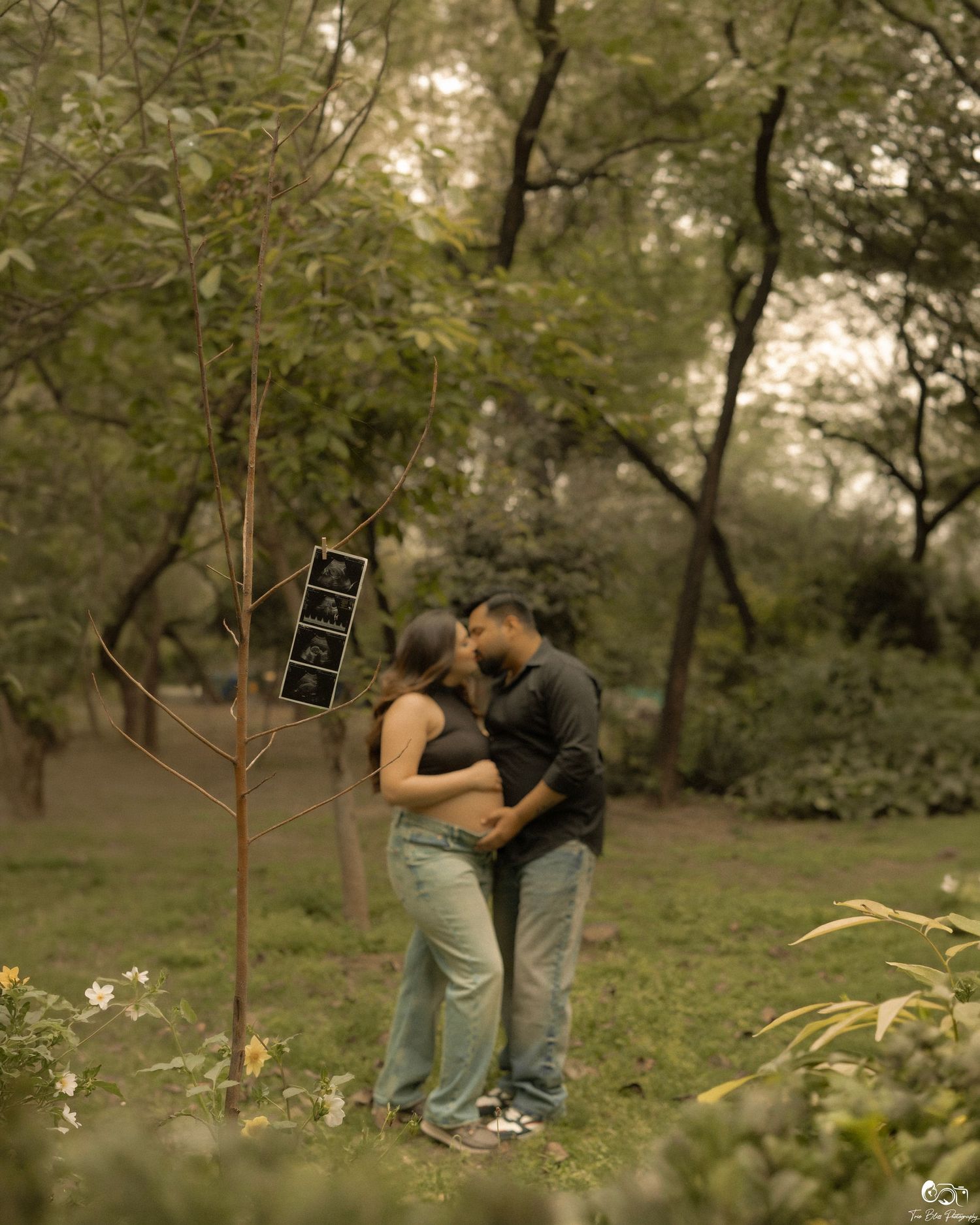 Couple sharing a tender moment in a lush green park during a maternity photoshoot with ultrasound images hanging on a tree.