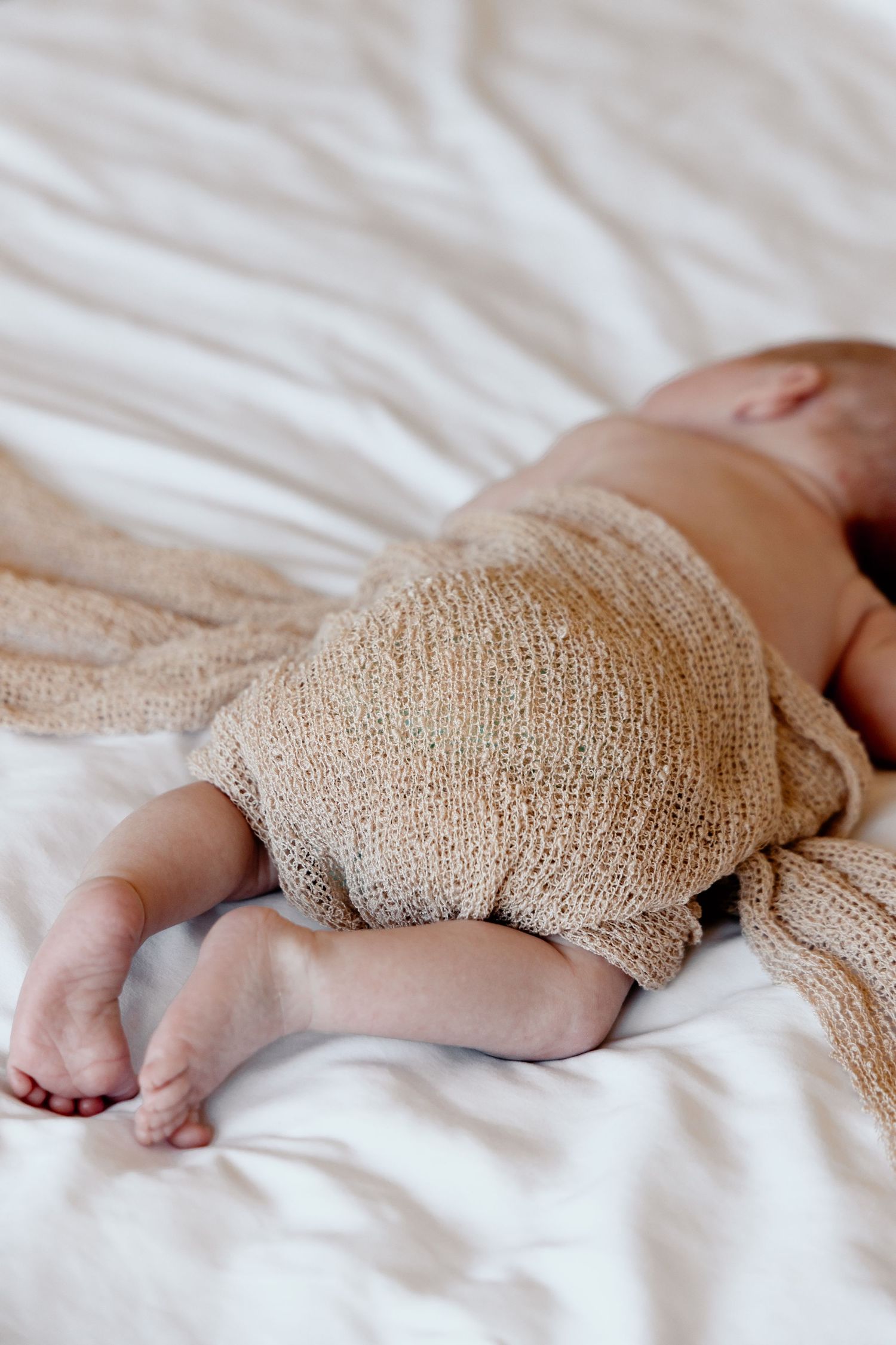 A row of medical bandages wrapped around limbs on white bedding shows a progression of wound care treatment.