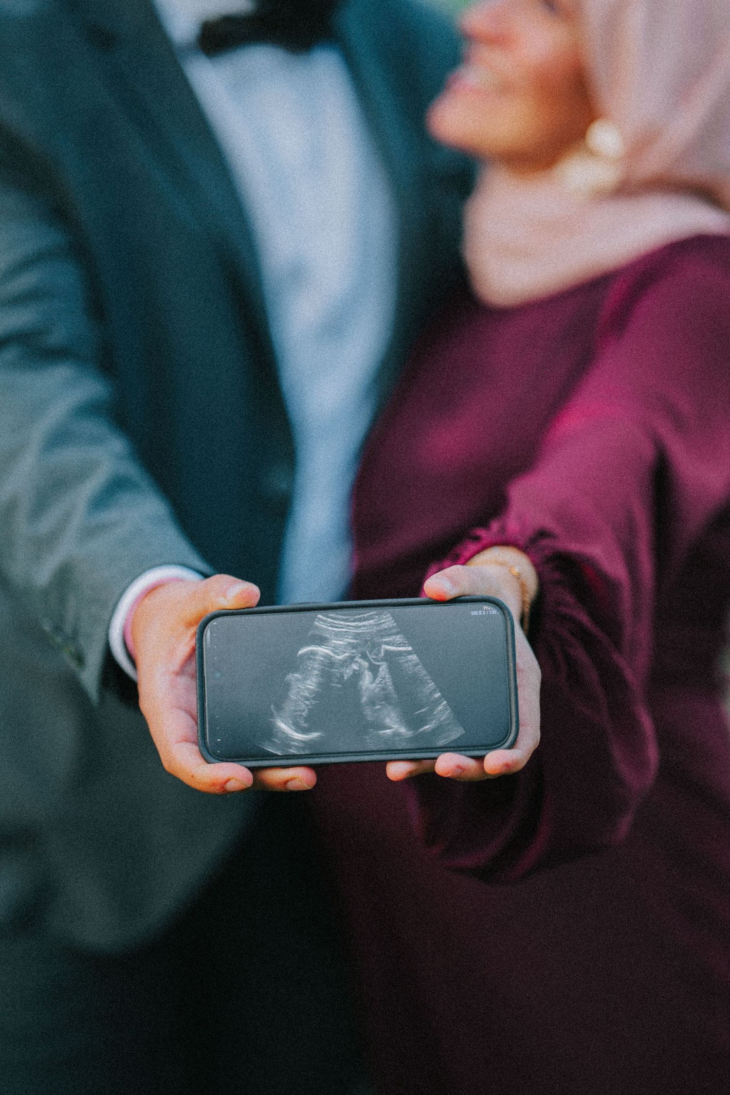 Hands holding a phone displaying an ultrasound image against dark formal attire.