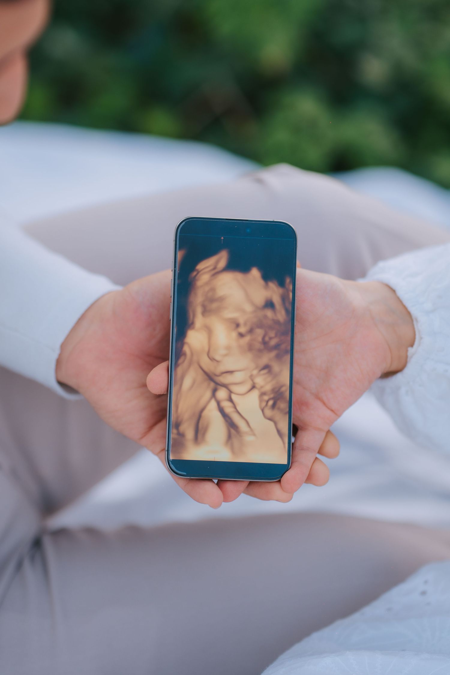 Hands holding a smartphone displaying an ultrasound image against a white background.