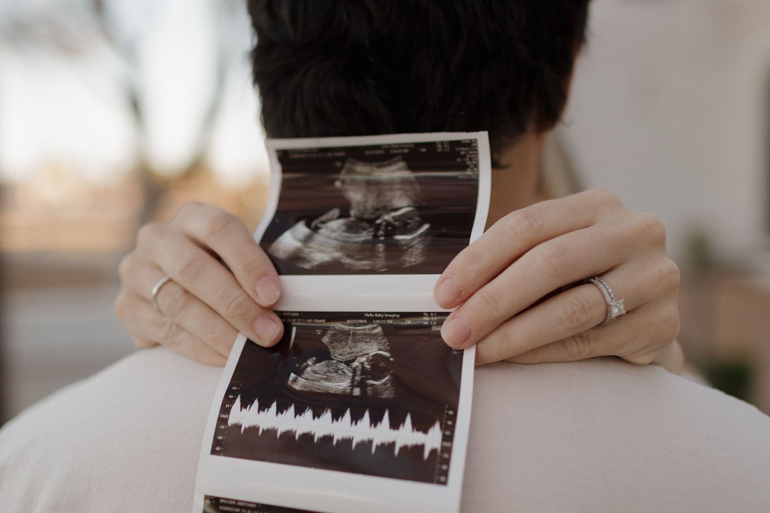 Close-up of hands holding black and white ultrasound scan photos.