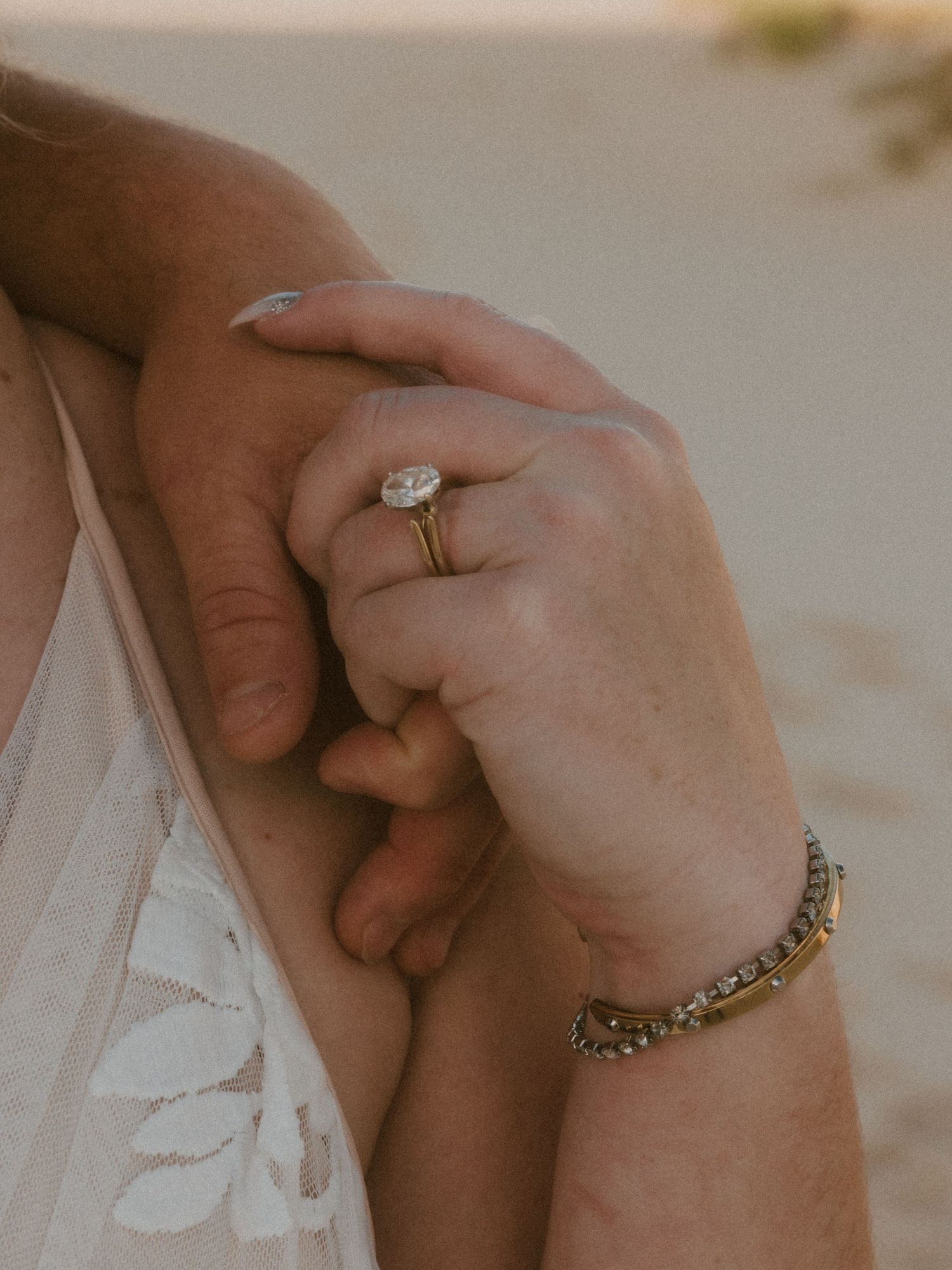 A close-up shot of hands with wedding rings and jewelry against lace fabric.