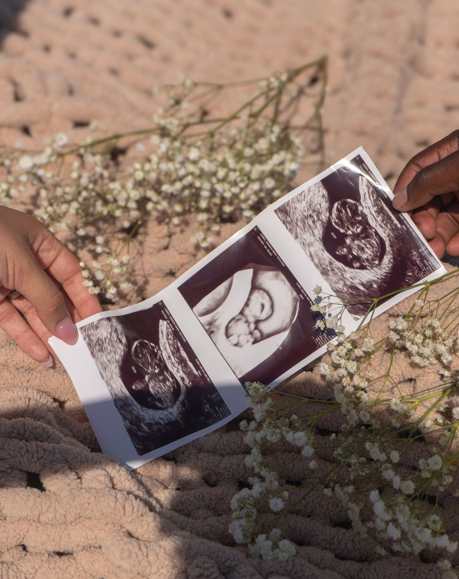 Two hands holding ultrasound sonogram photos surrounded by delicate white baby's breath flowers.