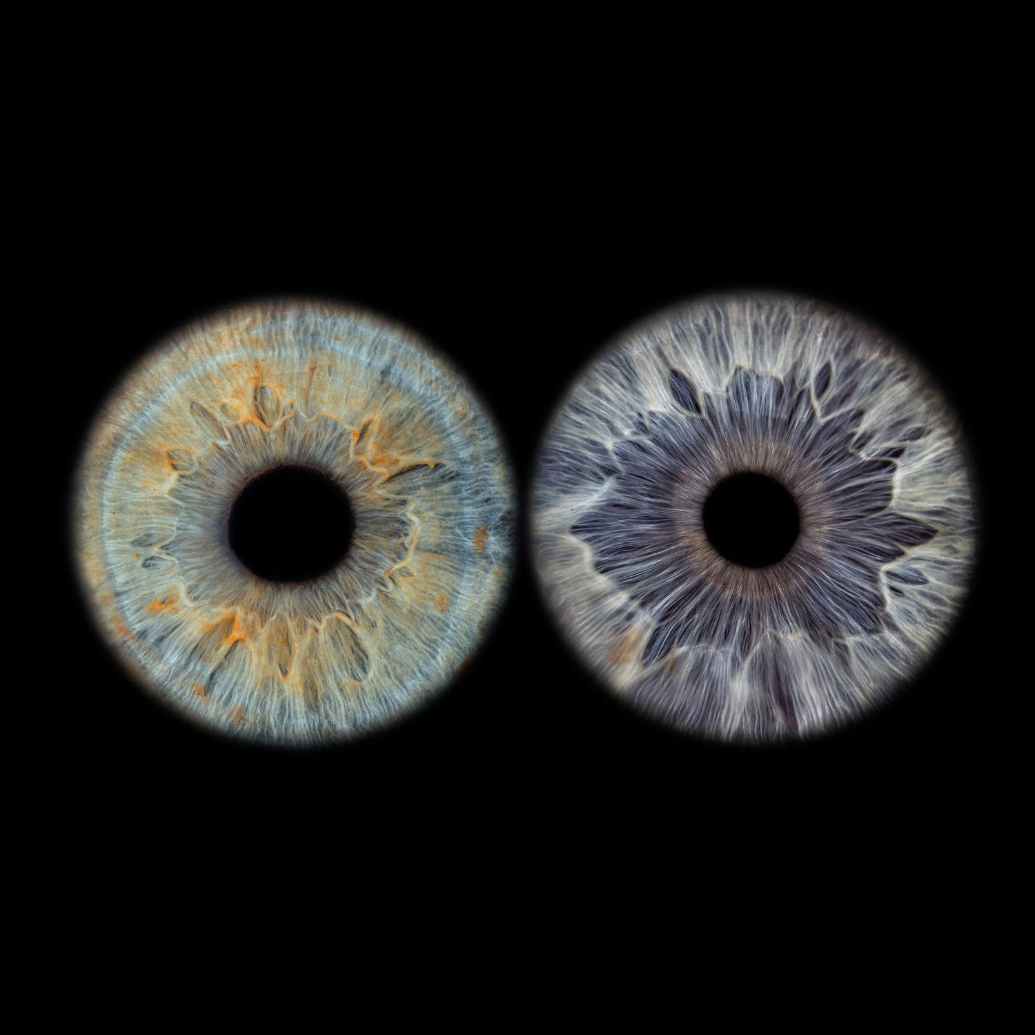 Two detailed macro photographs of human irises side by side, one blue-gold and one blue-gray, against a black background.